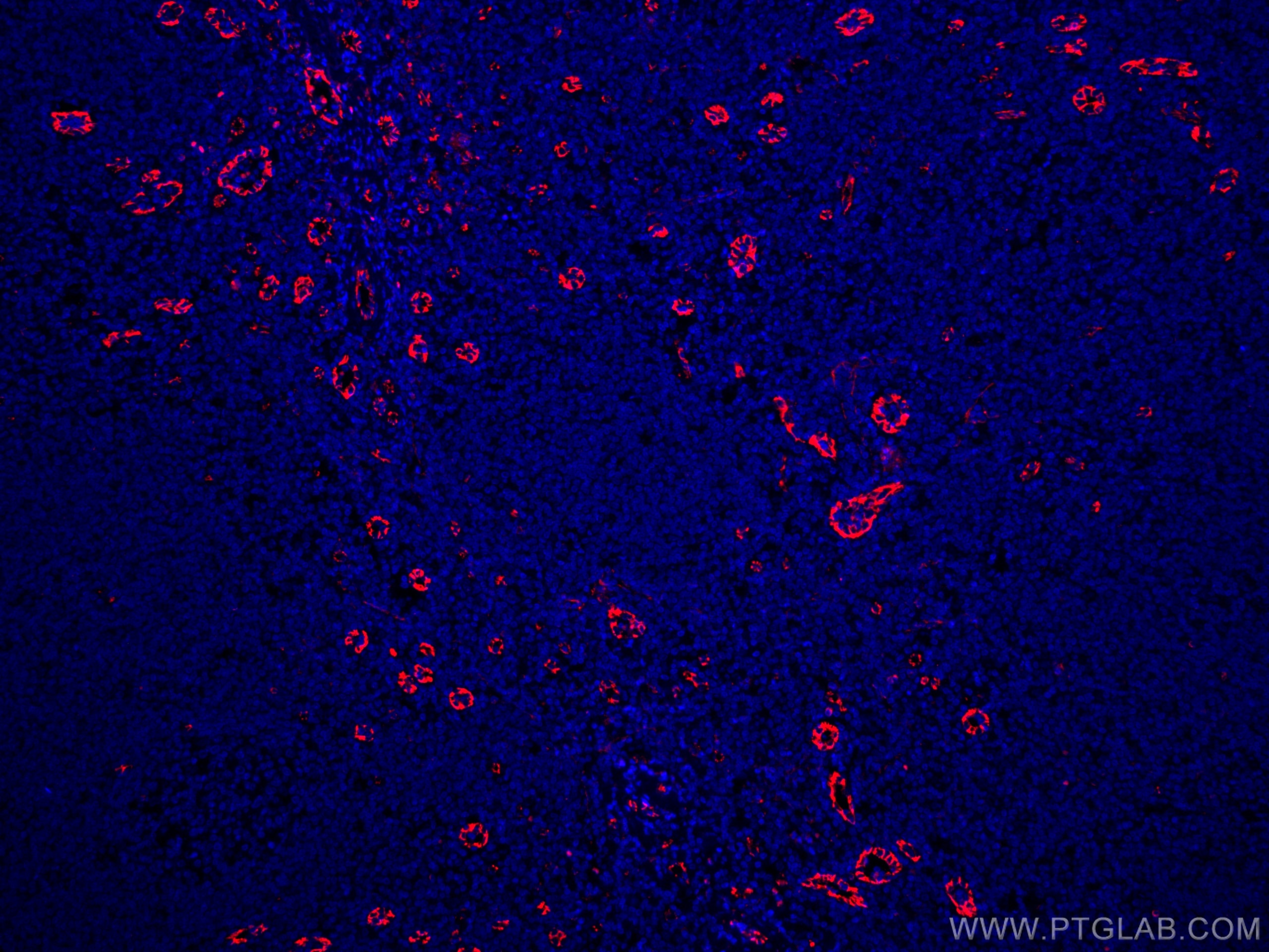 Immunofluorescence (IF) / fluorescent staining of human tonsillitis tissue using CoraLite®594-conjugated CD31 Monoclonal antibody (CL594-66065)