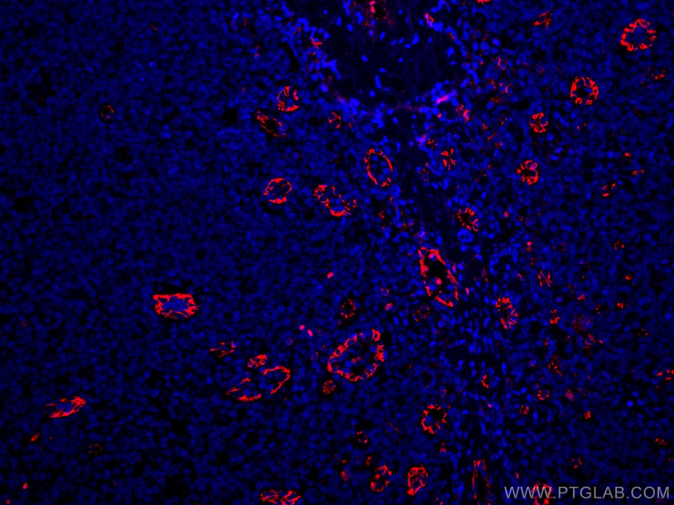IF Staining of human tonsillitis using CL594-66065