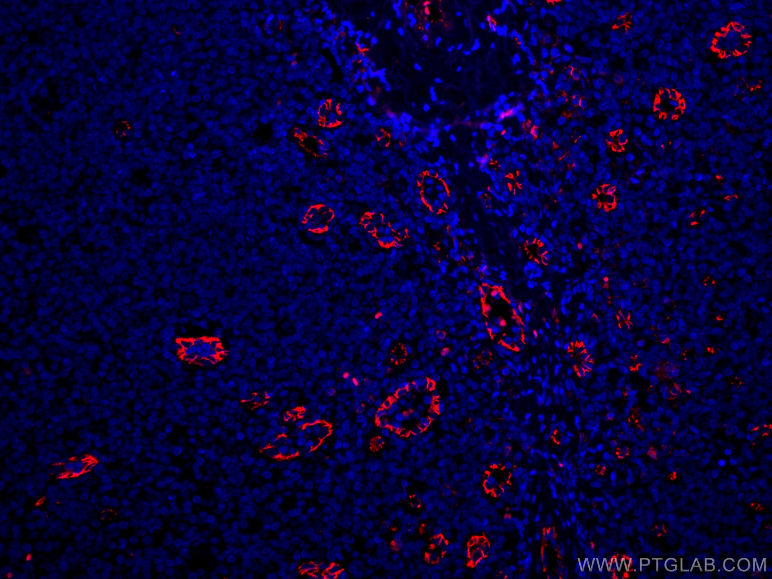 Immunofluorescence (IF) / fluorescent staining of human tonsillitis tissue using CoraLite®594-conjugated CD31 Monoclonal antibody (CL594-66065)