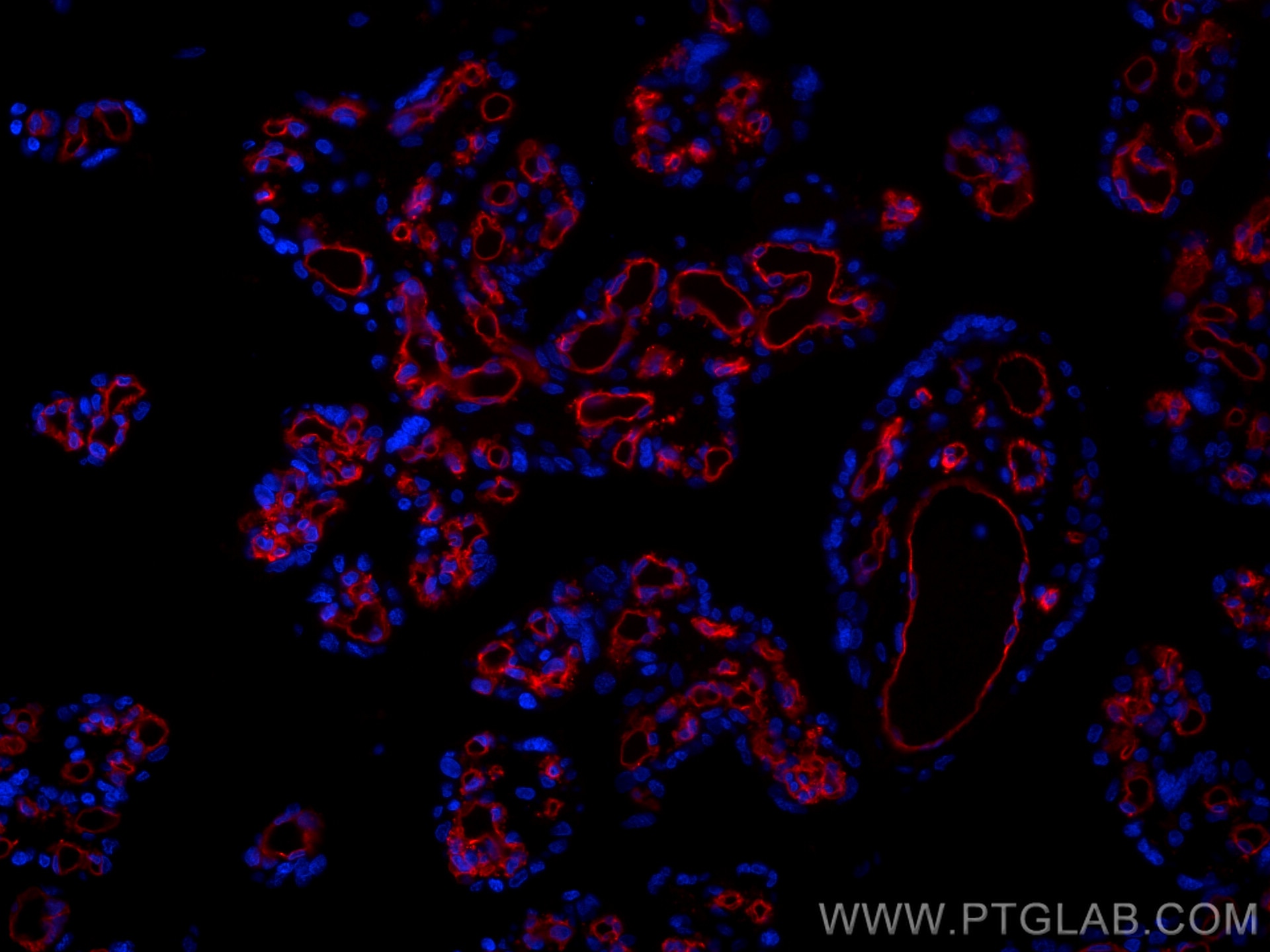 Immunofluorescence (IF) / fluorescent staining of human placenta tissue using CoraLite®594-conjugated CD31 Monoclonal antibody (CL594-66065)