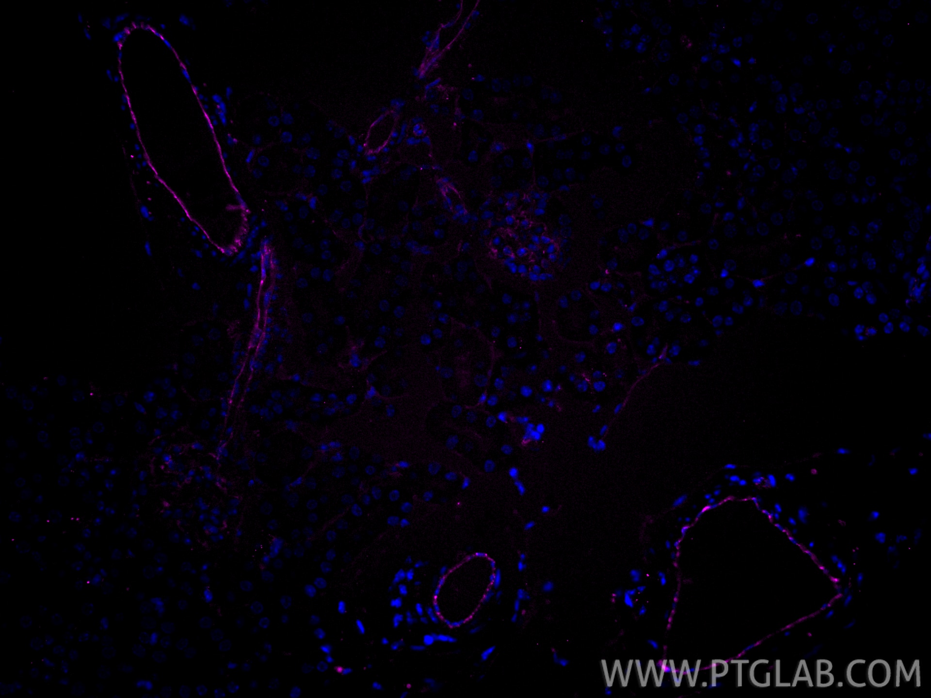 Immunofluorescent analysis of (4% PFA) fixed paraffin-embedded mouse kidney tissue using CoraLite® Plus 647 CD31 antibody (CL647-28083) at dilution of 1:200. Heat mediated antigen retrieval with Tris-EDTA buffer (pH 9.0). Immunofluorescence (IF) / fluorescent staining of mouse kidney tissue using CoraLite® Plus 647-conjugated CD31 Polyclonal anti (CL647-28083)