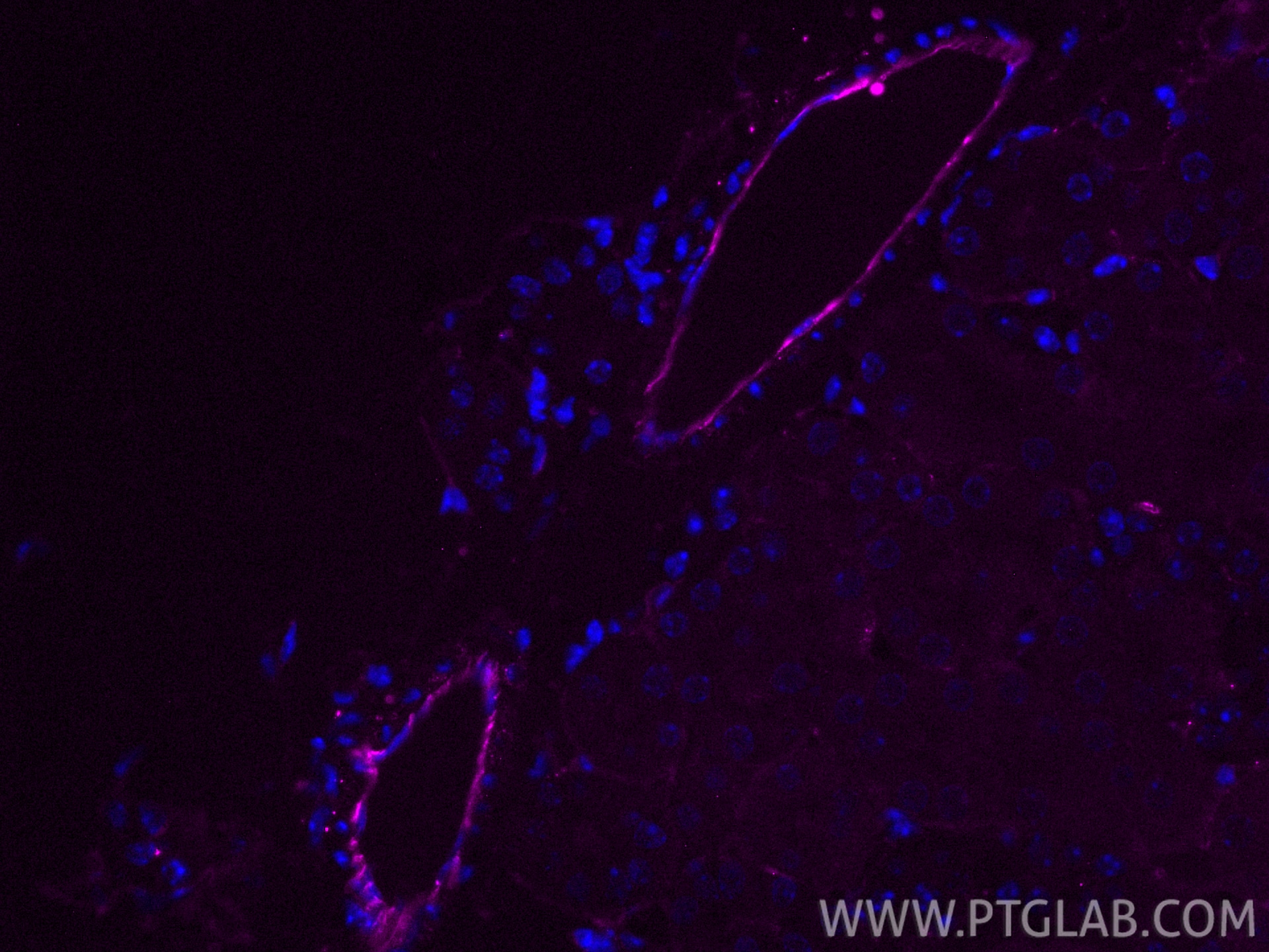 Immunofluorescent analysis of (4% PFA) fixed paraffin-embedded mouse kidney tissue using CoraLite® Plus 647 CD31 antibody (CL647-28083) at dilution of 1:200. Heat mediated antigen retrieval with Tris-EDTA buffer (pH 9.0). Immunofluorescence (IF) / fluorescent staining of mouse kidney tissue using CoraLite® Plus 647-conjugated CD31 Polyclonal anti (CL647-28083)