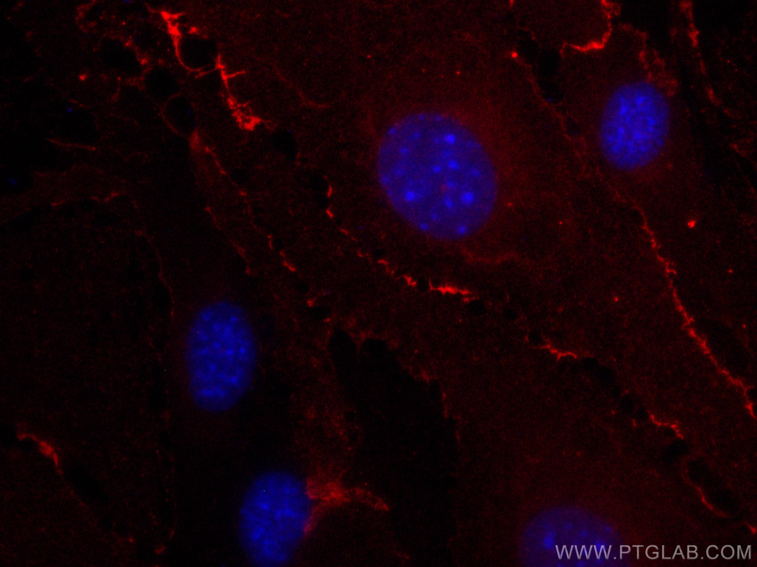 Immunofluorescence (IF) / fluorescent staining of bEnd.3 cells using CoraLite® Plus 647 Anti-Mouse CD31 (390) (CL647-65058)
