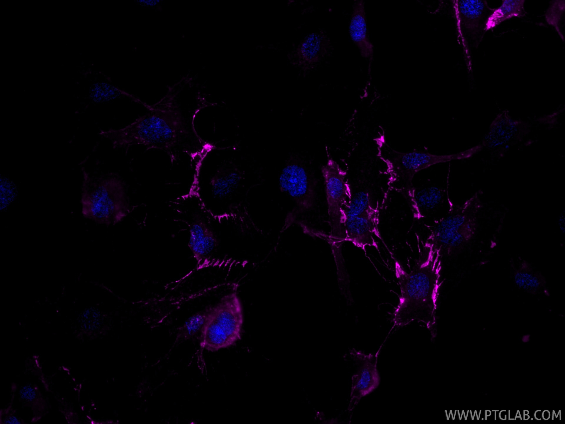 Immunofluorescence (IF) / fluorescent staining of HUVEC cells using CoraLite® Plus 647-conjugated CD31 Recombinant mon (CL647-80530)