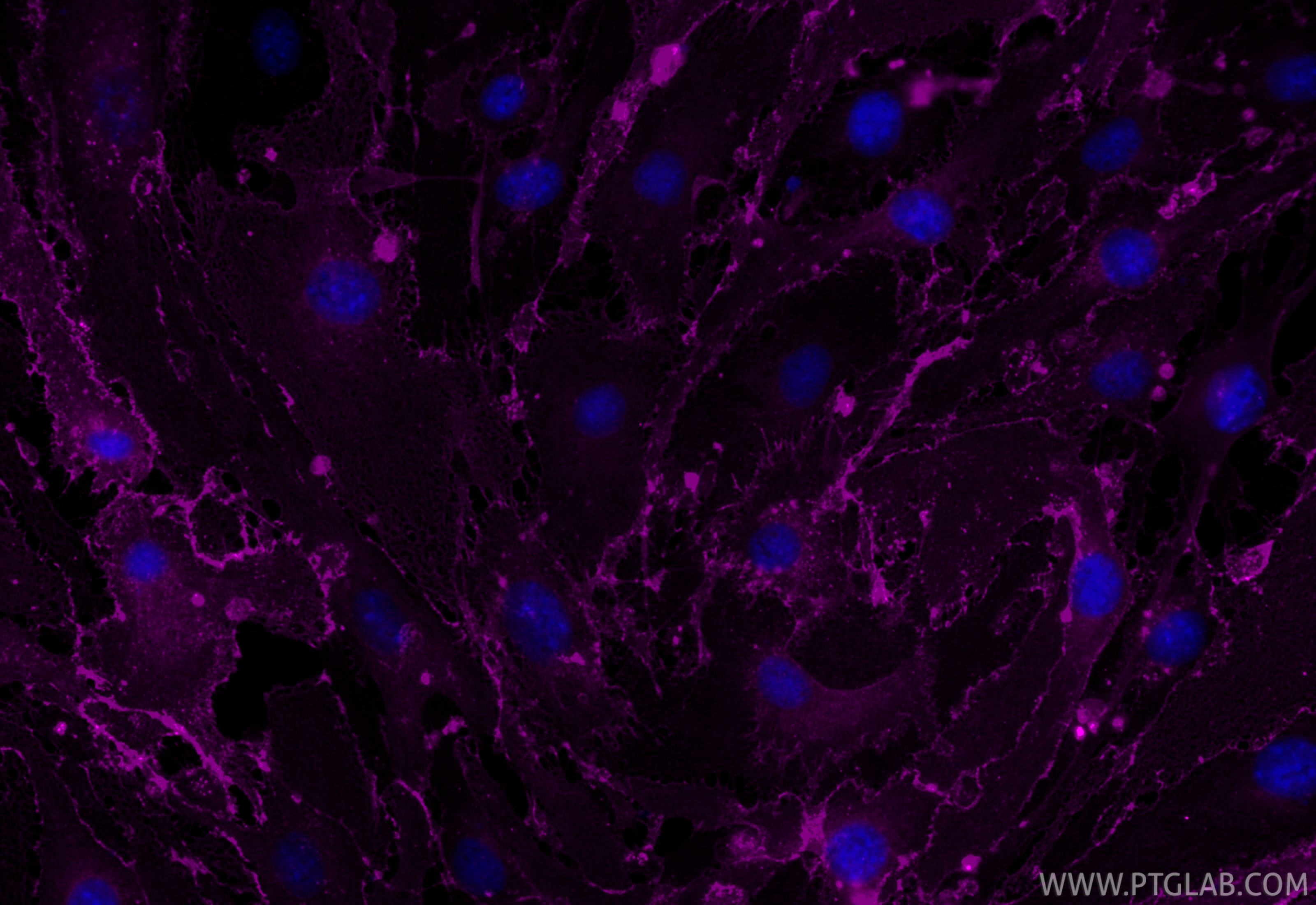 Immunofluorescence (IF) / fluorescent staining of bEnd.3 cells using CoraLite® Plus 647-conjugated CD31 Recombinant mon (CL647-84607-4)