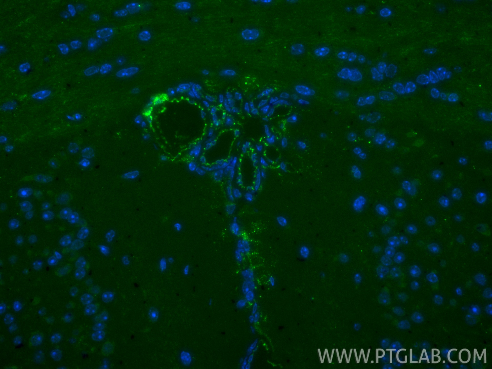 IF Staining of mouse brain using FITC-28083 Immunofluorescence (IF) / fluorescent staining of mouse brain tissue using FITC Plus-conjugated CD31 Polyclonal antibody (FITC-28083)