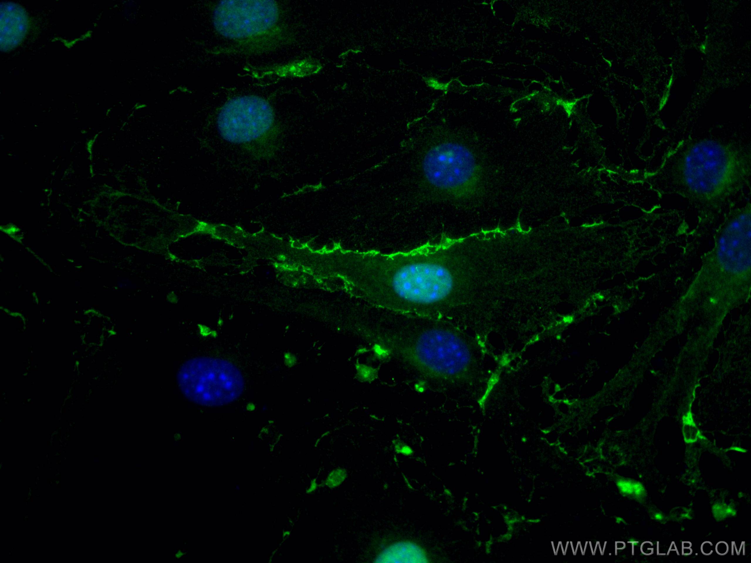 Immunofluorescence (IF) / fluorescent staining of bEnd.3 cells using FITC Plus Anti-Mouse CD31 (390) (FITC-65058)