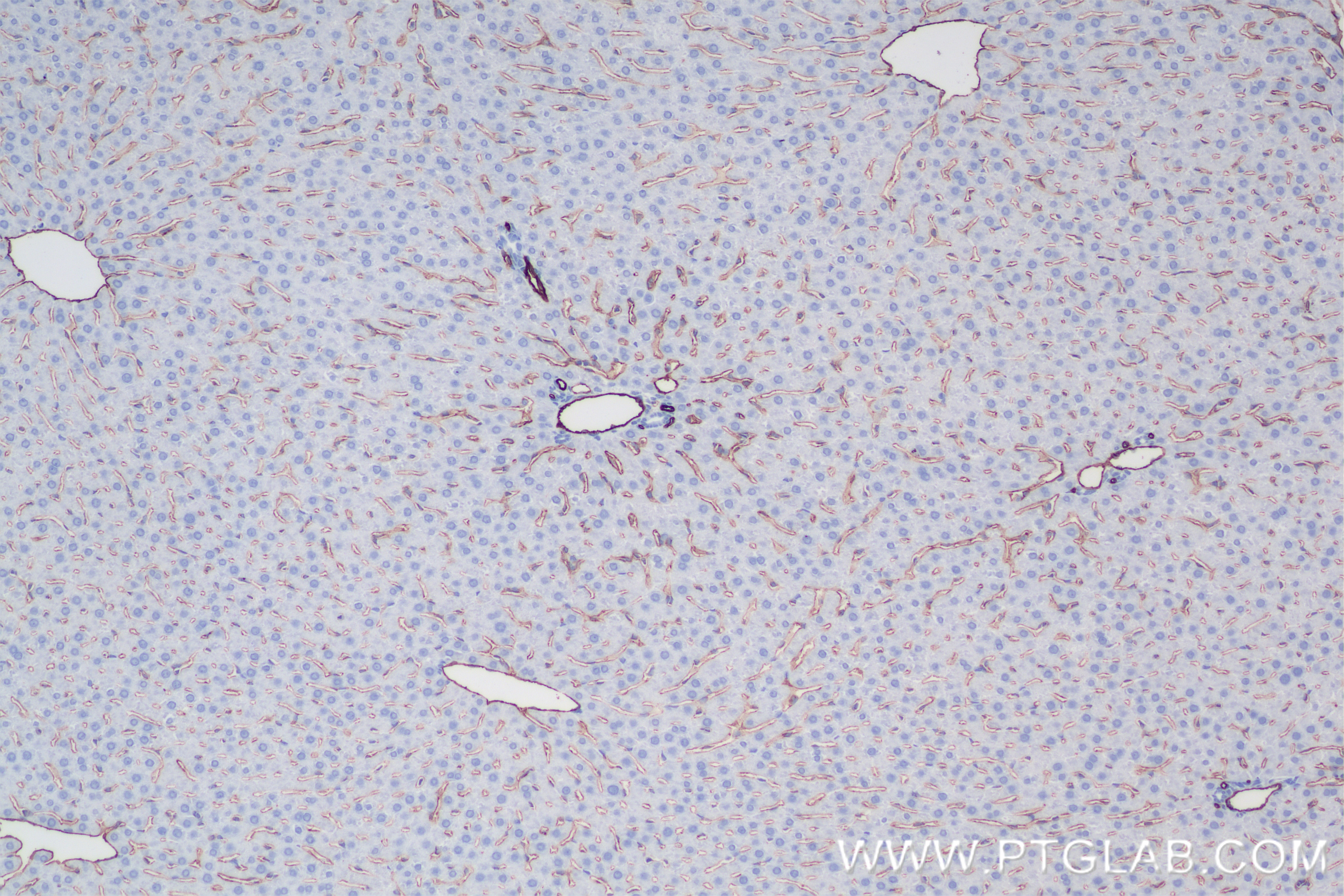 Immunohistochemistry (IHC) staining of rat liver tissue using CD31/PECAM-1 Recombinant antibody (85898-4-RR)