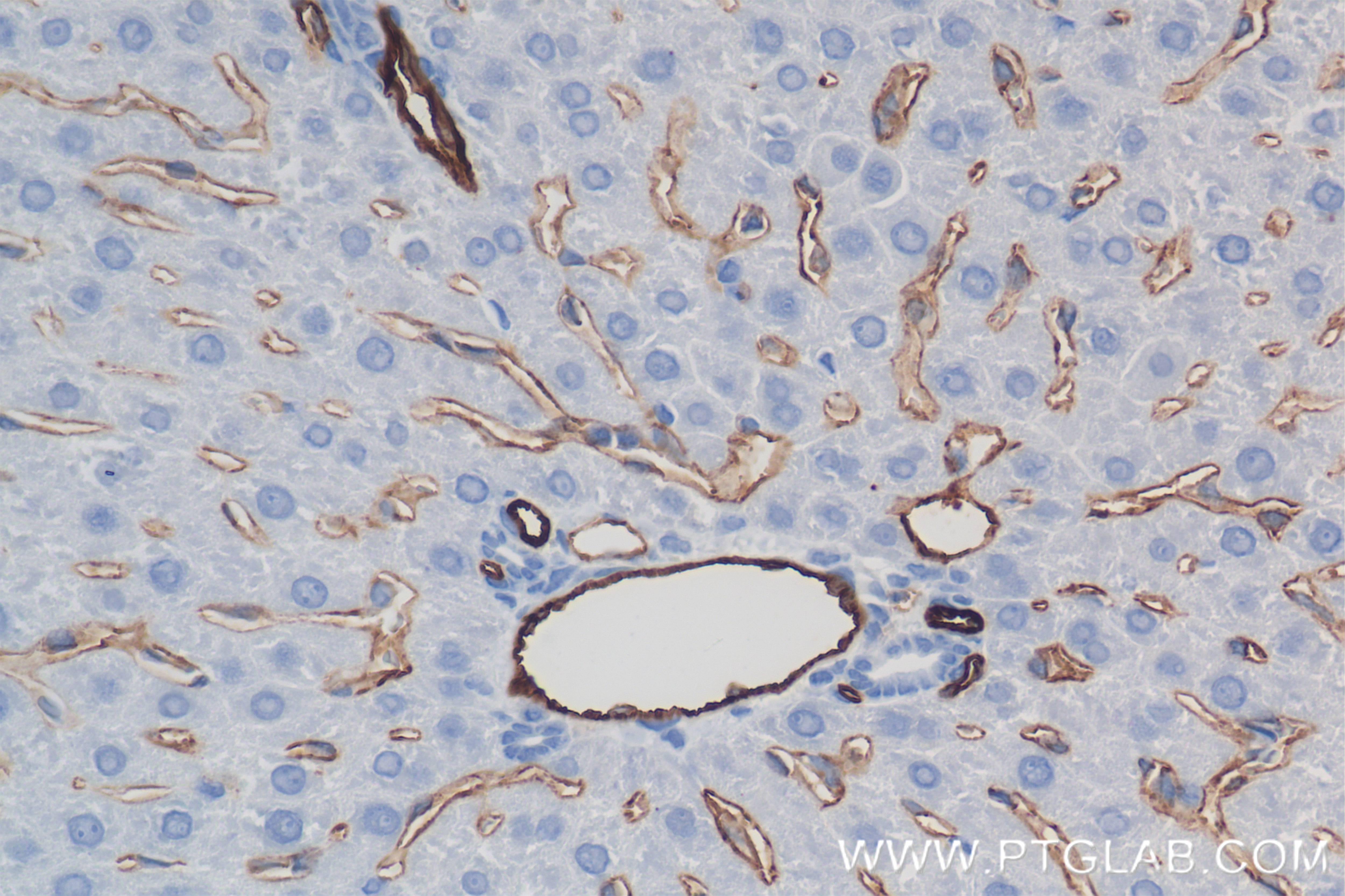 Immunohistochemistry (IHC) staining of rat liver tissue using CD31/PECAM-1 Recombinant antibody (85898-4-RR)