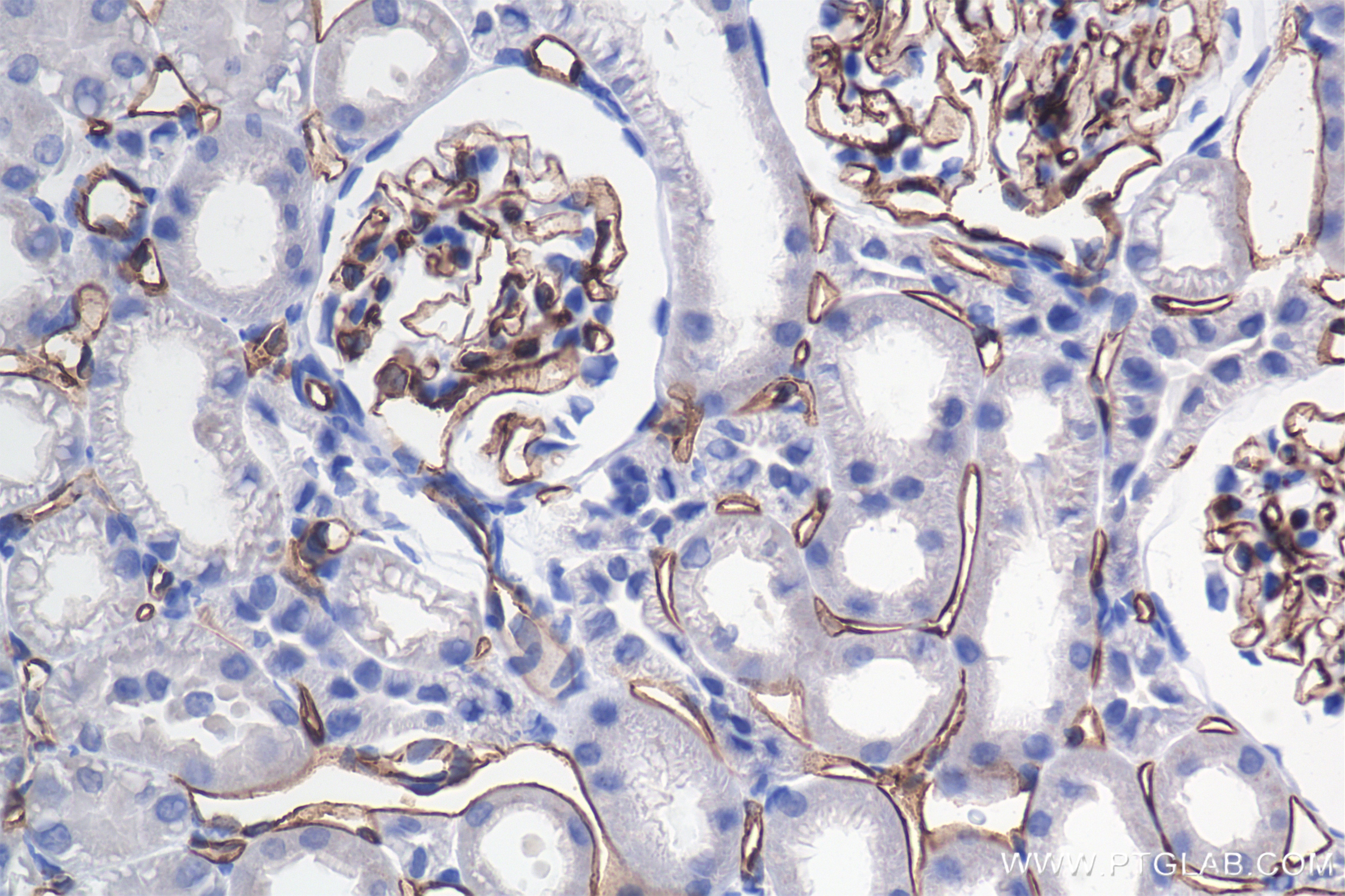 Immunohistochemistry (IHC) staining of rat kidney tissue using CD31 Recombinant antibody (85898-4-RR)