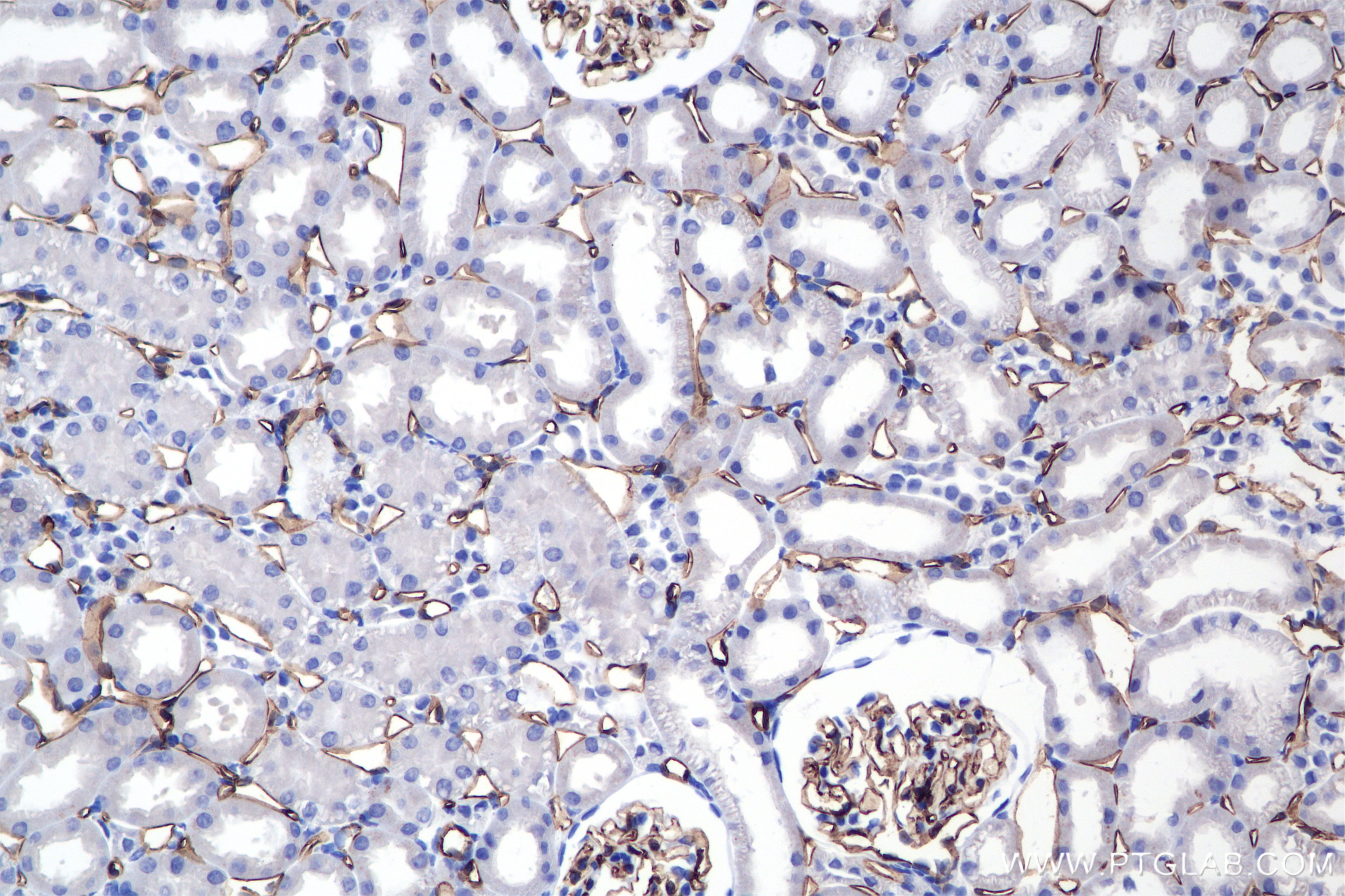 Immunohistochemistry (IHC) staining of rat kidney tissue using CD31 Recombinant antibody (85898-4-RR)