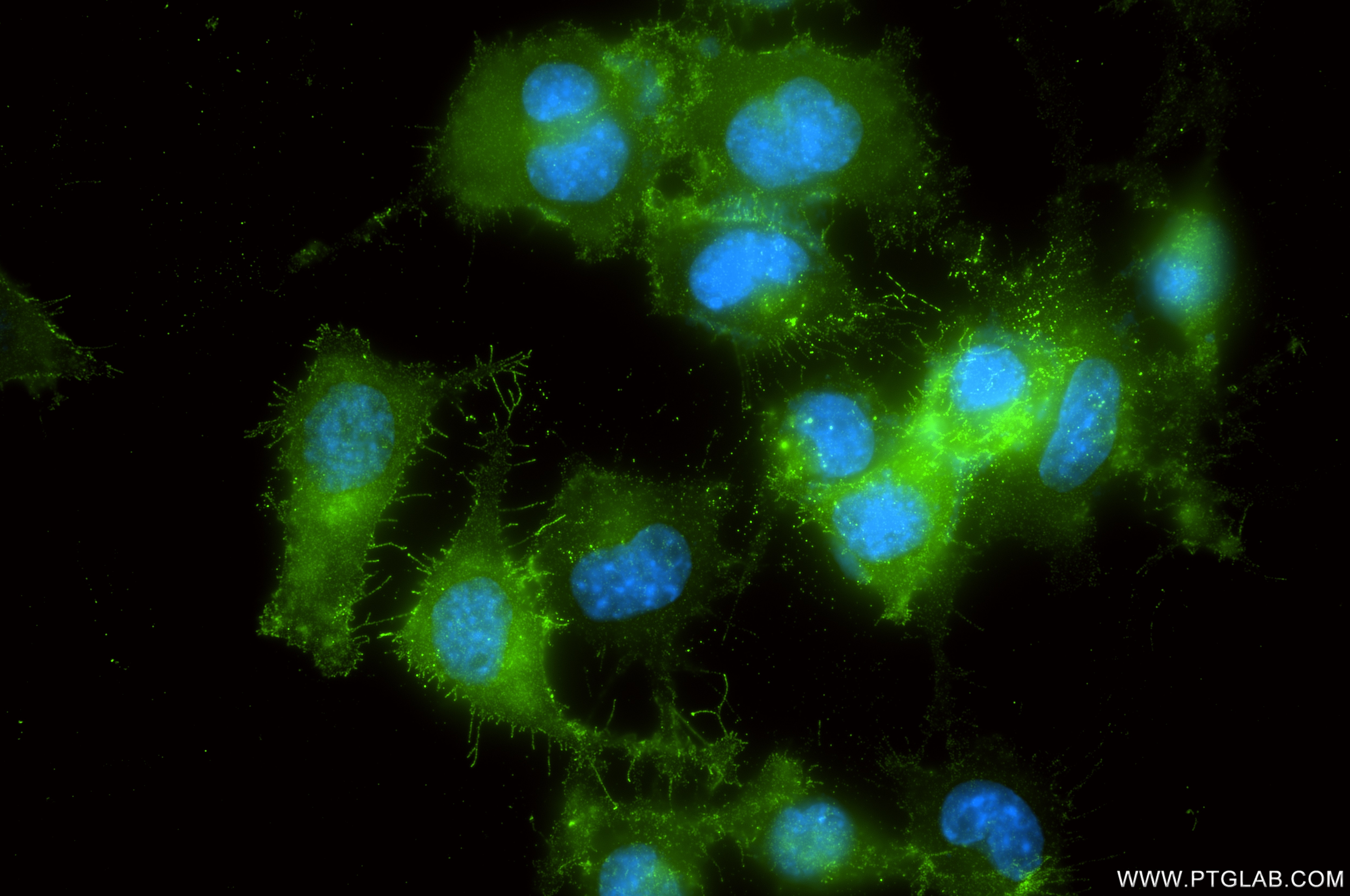 Immunofluorescence (IF) / fluorescent staining of Neuro-2a cells using CD316/IGSF8 Recombinant monoclonal antibody (87310-1-RR)