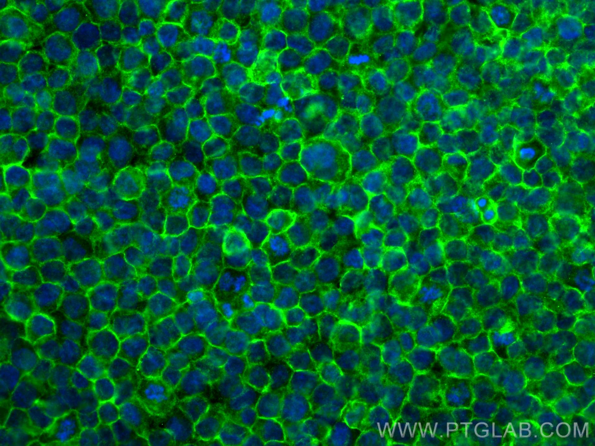 Immunofluorescence (IF) / fluorescent staining of THP-1 cells using FCGR2A / CD32a Monoclonal antibody (66529-1-Ig)