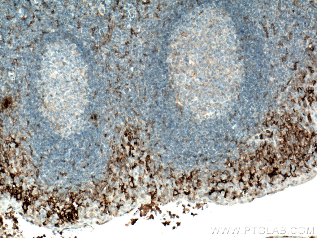 Immunohistochemistry (IHC) staining of human tonsillitis tissue using FCGR2A / CD32a Monoclonal antibody (66529-1-Ig)