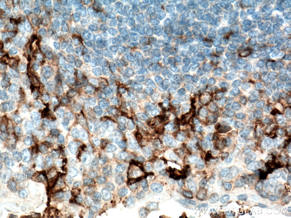 Immunohistochemistry (IHC) staining of human tonsillitis tissue using FCGR2A / CD32a Monoclonal antibody (66529-1-Ig)