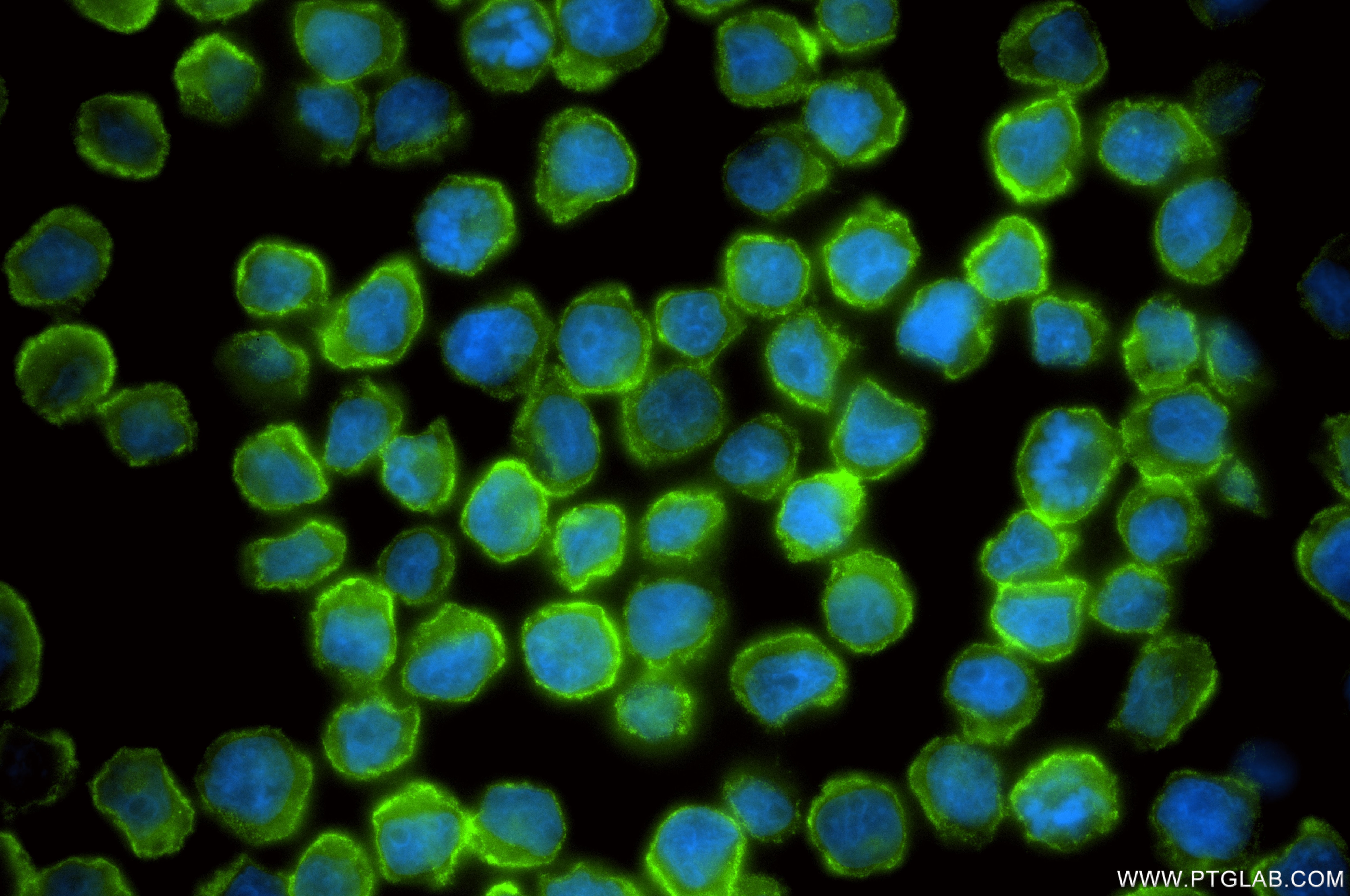 Immunofluorescent analysis of (4% PFA) fixed U-937 cells using CD32 antibody (86588-2-RR, Clone: 251087D9 ) at dilution of 1:200 and CoraLite®488-Conjugated Goat Anti-Rabbit IgG(H+L) (SA00013-2). This data was developed using the same antibody clone with 86588-2-PBS in a different storage buffer formulation. Immunofluorescence (IF) / fluorescent staining of U-937 cells using CD32 Recombinant monoclonal antibody (86588-2-RR)