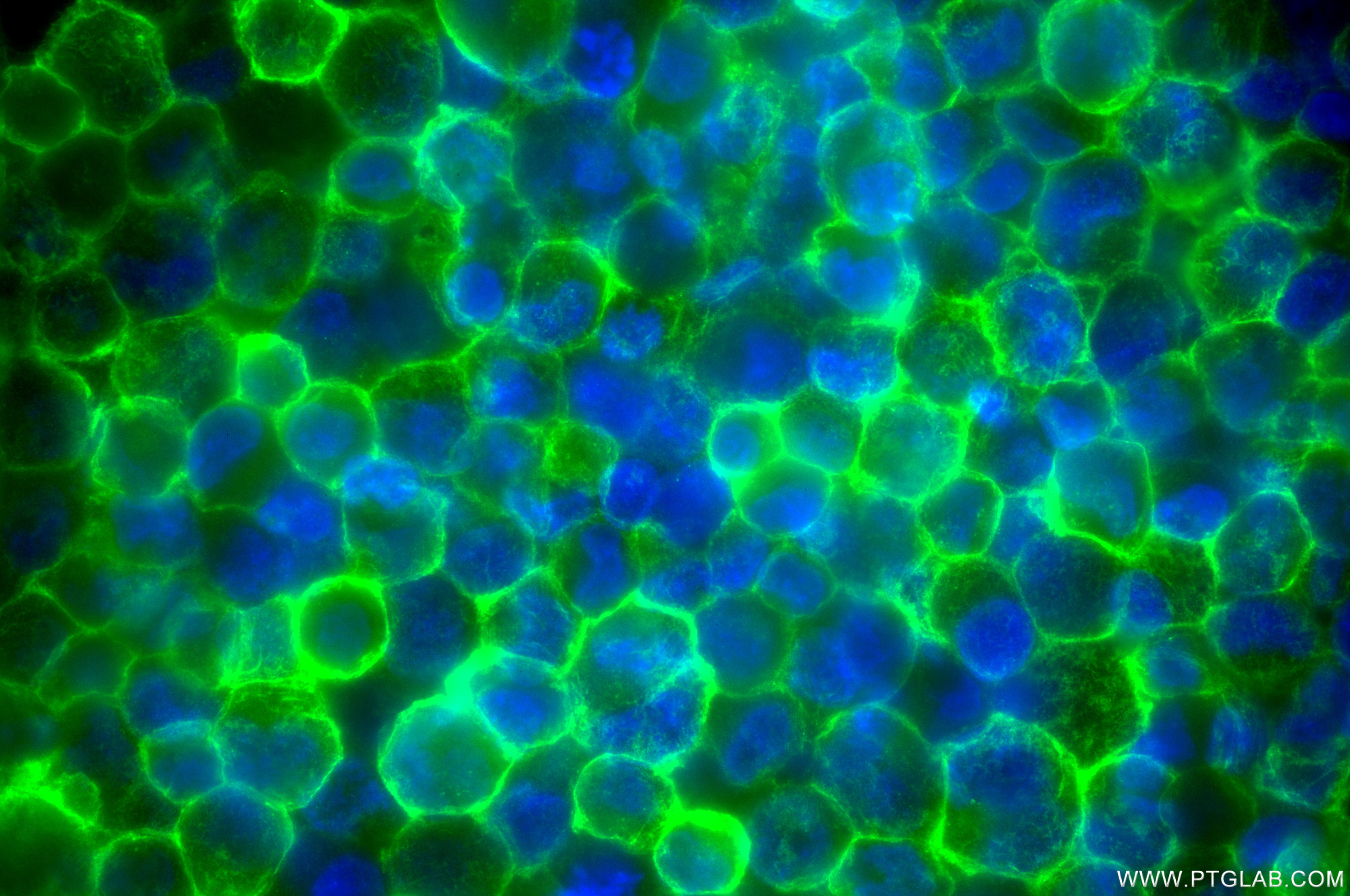 Immunofluorescent analysis of (4% PFA) fixed K-562 cells using CD32 antibody (86588-2-RR, Clone: 251087D9 ) at dilution of 1:200 and CoraLite®488-Conjugated Goat Anti-Rabbit IgG(H+L) (SA00013-2). This data was developed using the same antibody clone with 86588-2-PBS in a different storage buffer formulation. Immunofluorescence (IF) / fluorescent staining of K-562 cells using CD32 Recombinant monoclonal antibody (86588-2-RR)