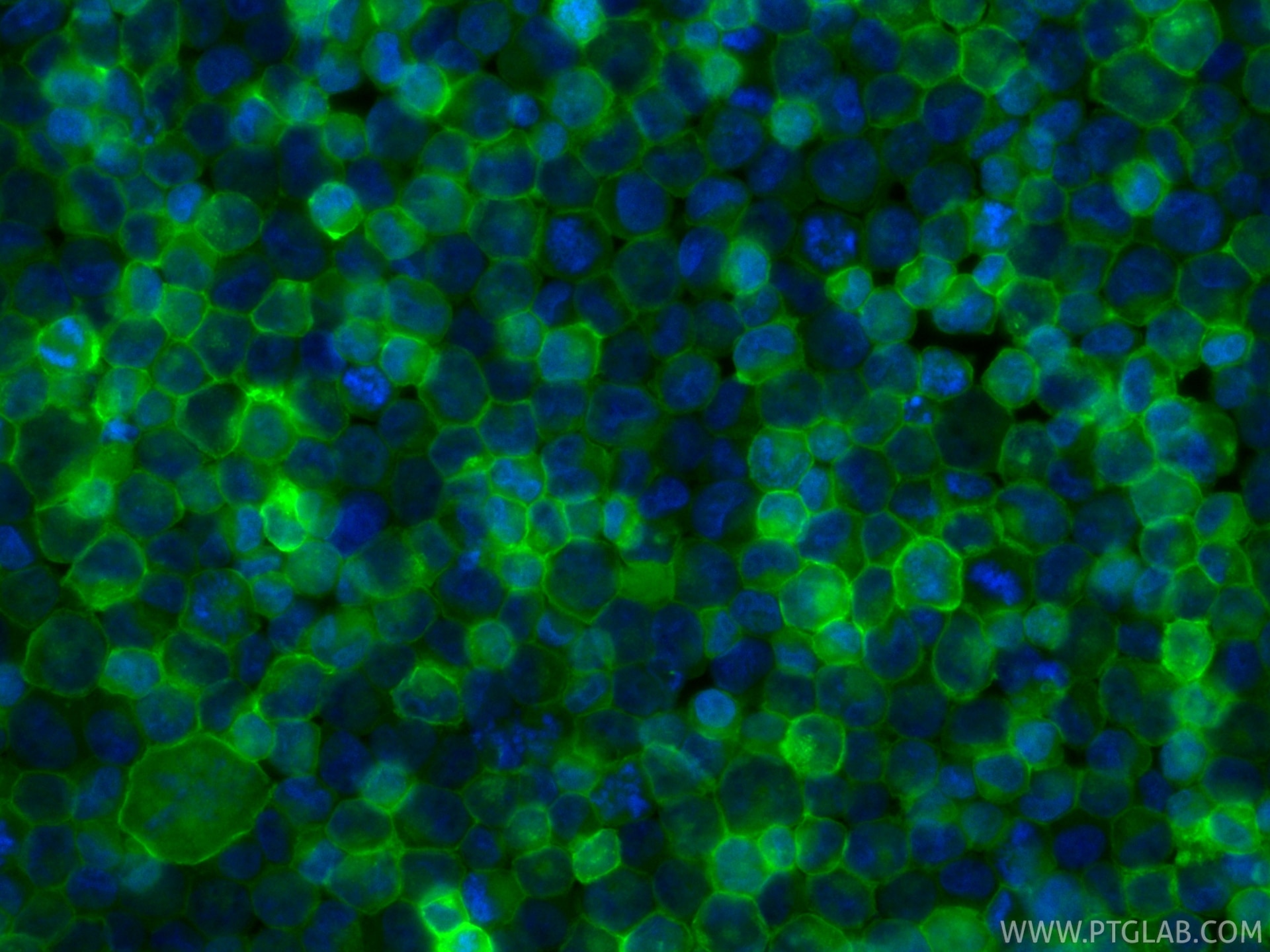 IF Staining of K-562 using CL488-86588-2 Immunofluorescence (IF) / fluorescent staining of K-562 cells using CoraLite® Plus 488-conjugated CD32 Recombinant mon (CL488-86588-2)