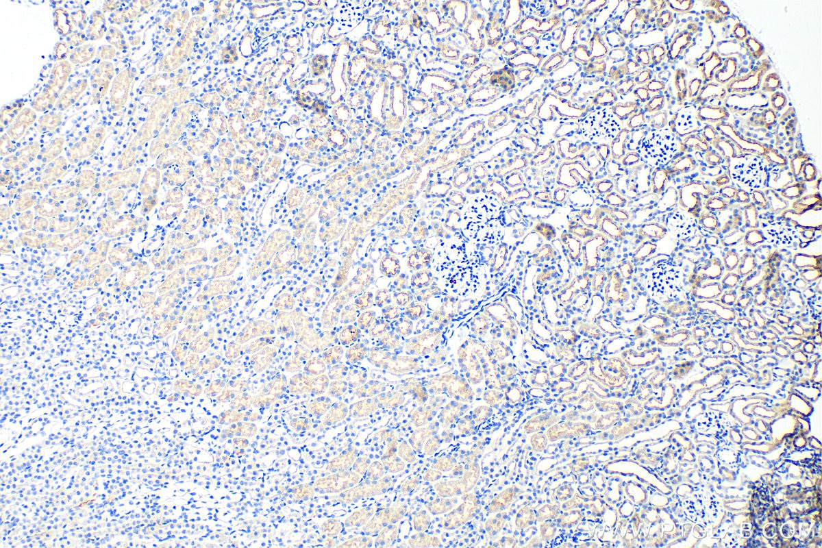 Immunohistochemistry (IHC) staining of mouse kidney tissue using CD320 Polyclonal antibody (10343-1-AP)