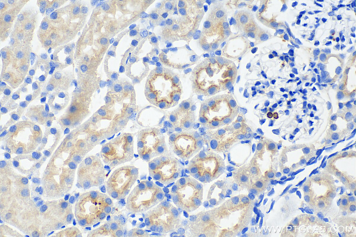Immunohistochemistry (IHC) staining of mouse kidney tissue using CD320 Polyclonal antibody (10343-1-AP)