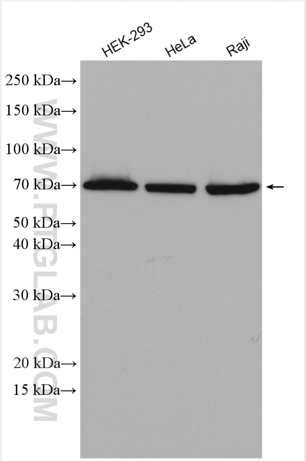 Western Blot (WB) analysis of various lysates using CD320 Polyclonal antibody (10343-1-AP)