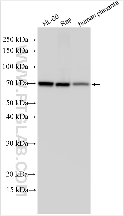 Western Blot (WB) analysis of various lysates using CD320 Polyclonal antibody (10343-1-AP)