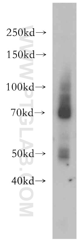 Western Blot (WB) analysis of mouse heart tissue using CD320 Polyclonal antibody (10343-1-AP)