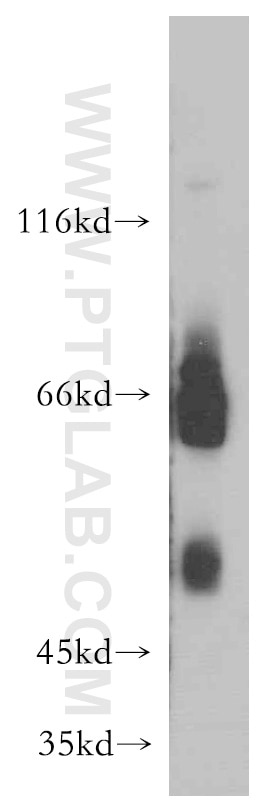 Western Blot (WB) analysis of HEK-293 cells using CD320 Polyclonal antibody (10343-1-AP)