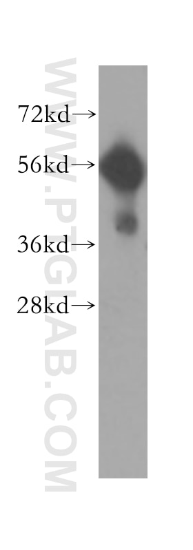 Western Blot (WB) analysis of human liver tissue using CD320 Polyclonal antibody (10343-1-AP)