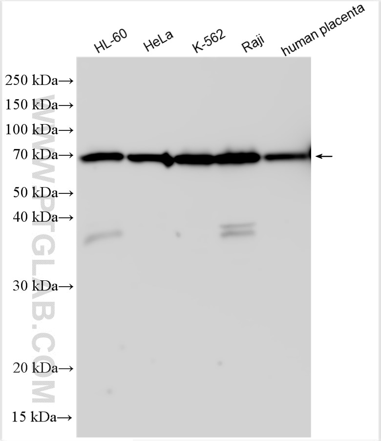 WB analysis using 24145-1-AP