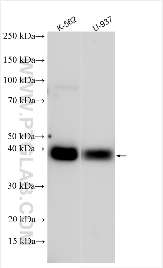 Western Blot (WB) analysis of various lysates using CD32A/C Polyclonal antibody (25323-1-AP)