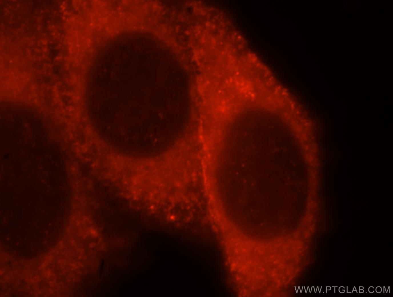 Immunofluorescence (IF) / fluorescent staining of HepG2 cells using CD33 Polyclonal antibody (17425-1-AP)