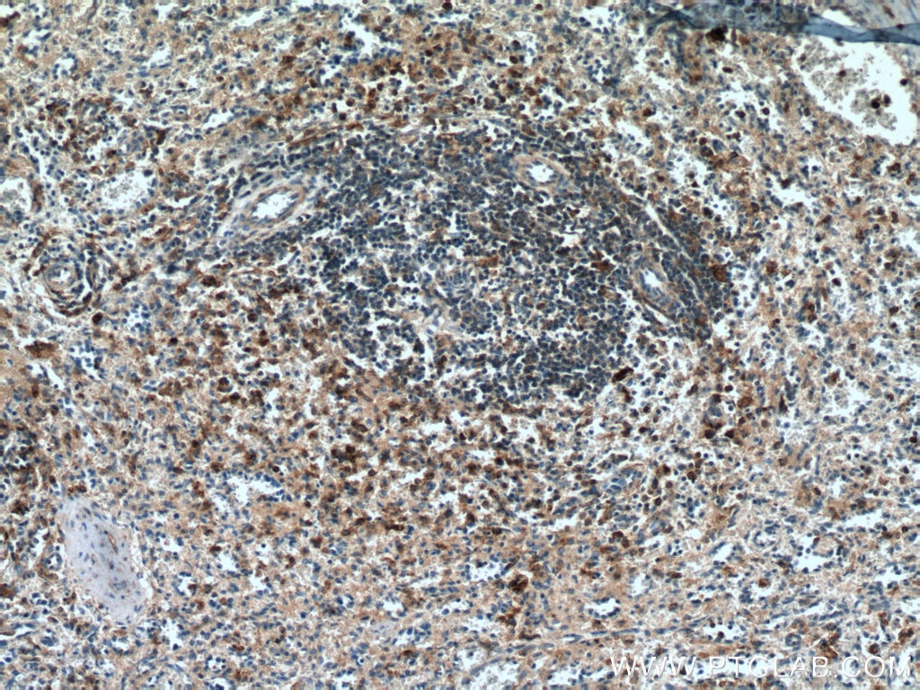 Immunohistochemistry (IHC) staining of human spleen tissue using CD33 Monoclonal antibody (67135-1-Ig)