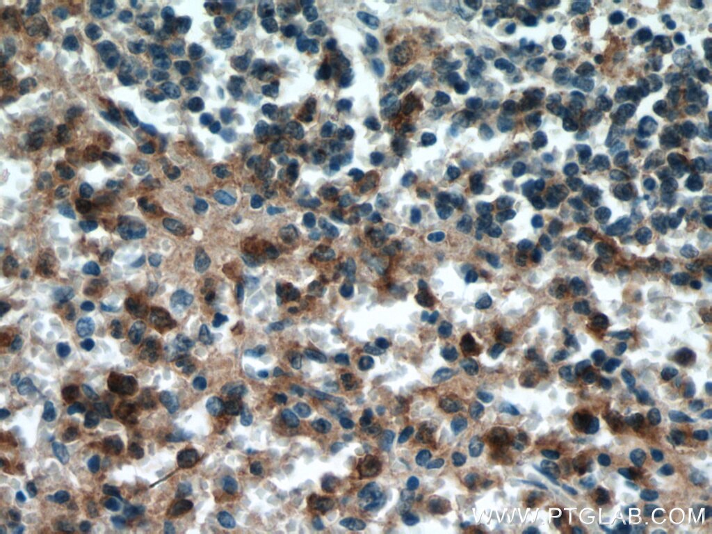 Immunohistochemistry (IHC) staining of human spleen tissue using CD33 Monoclonal antibody (67135-1-Ig)