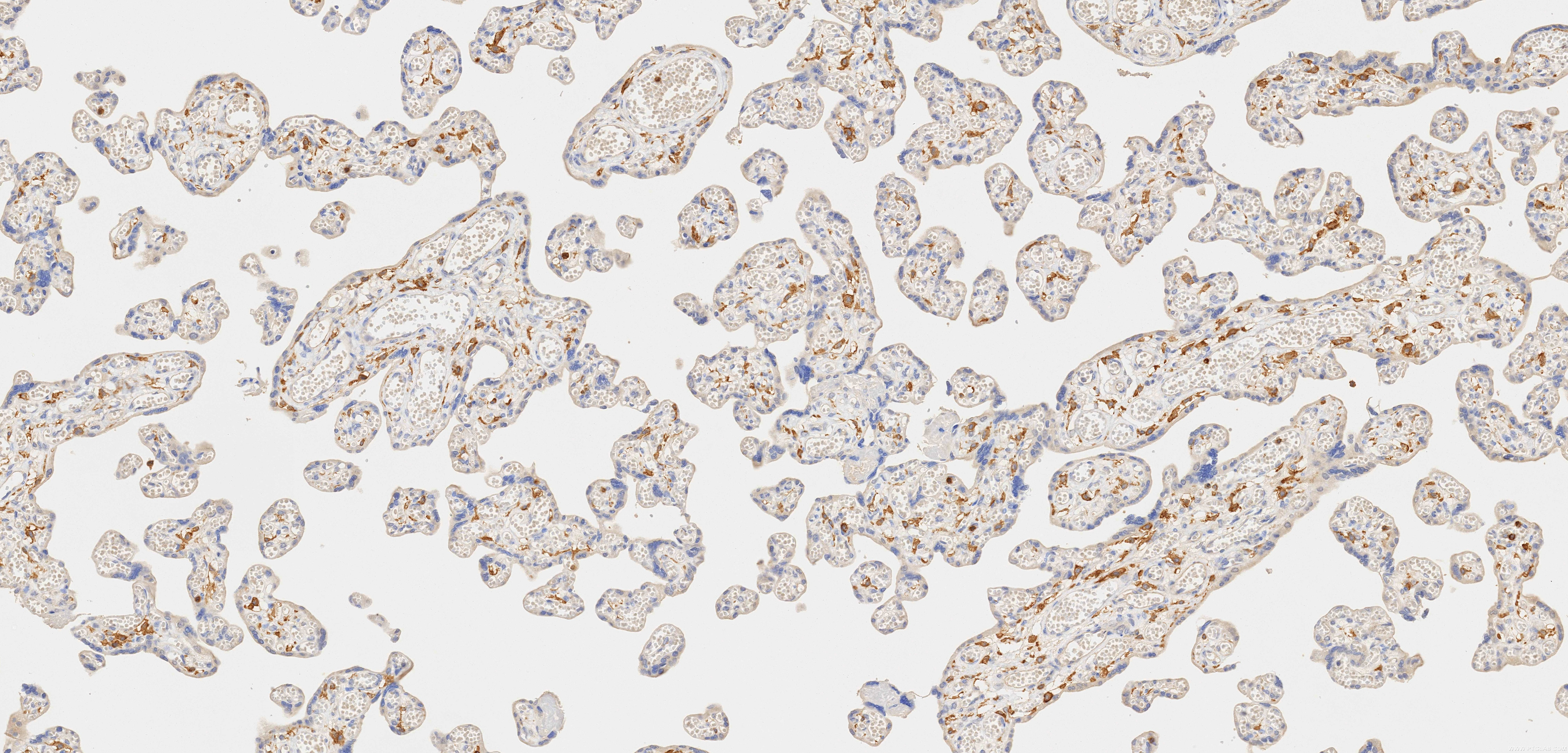 Immunohistochemistry (IHC) staining of human placenta tissue using CD33 Recombinant monoclonal antibody (84341-6-RR)