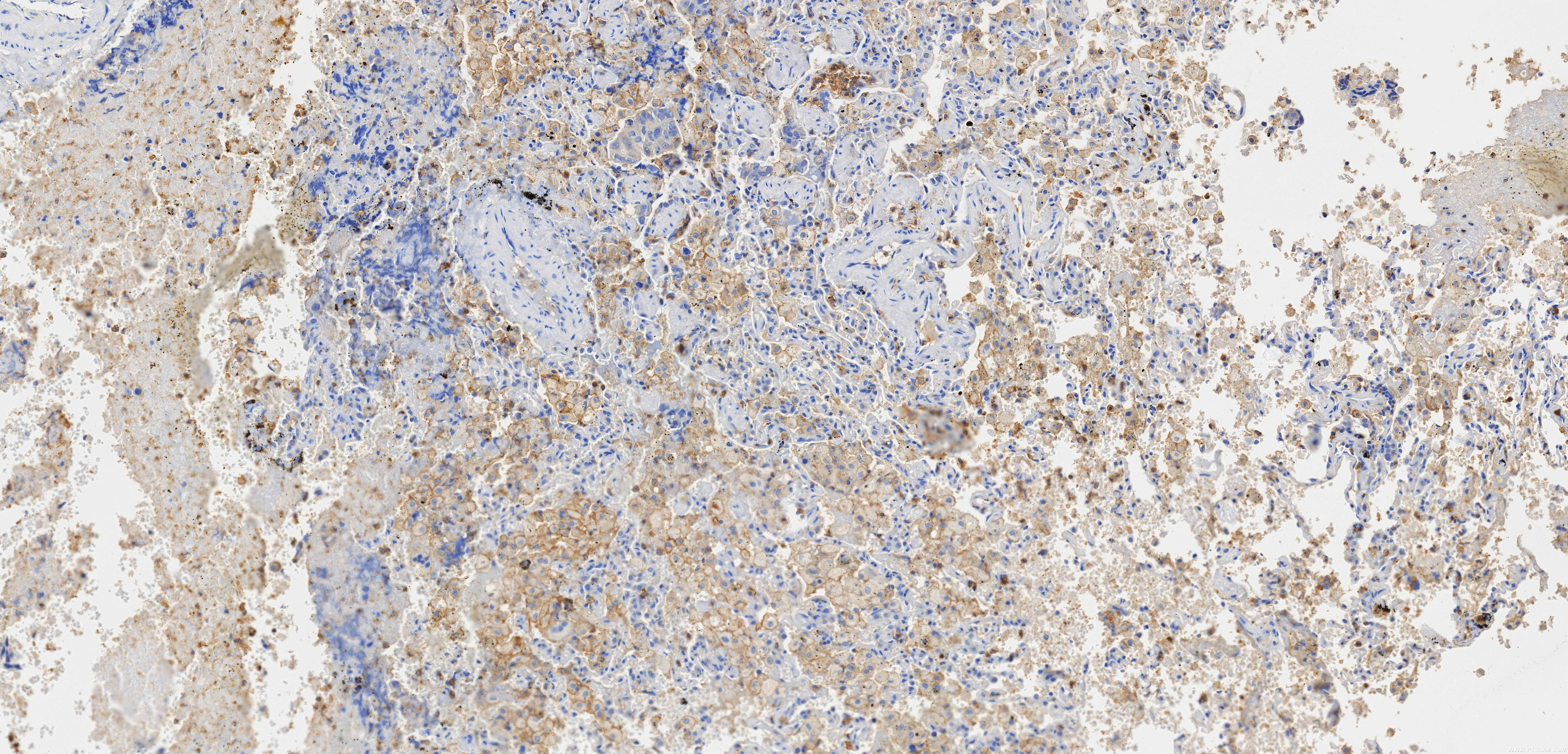 Immunohistochemistry (IHC) staining of human lung tissue using CD33 Recombinant monoclonal antibody (84341-6-RR)