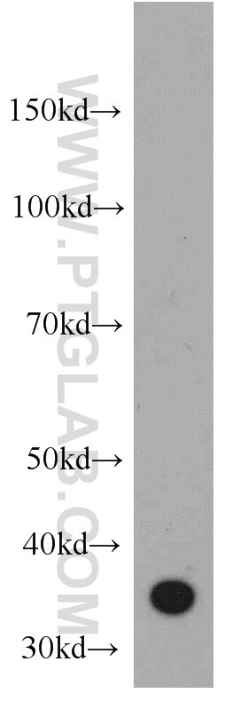 WB analysis of human spleen using 55118-1-AP