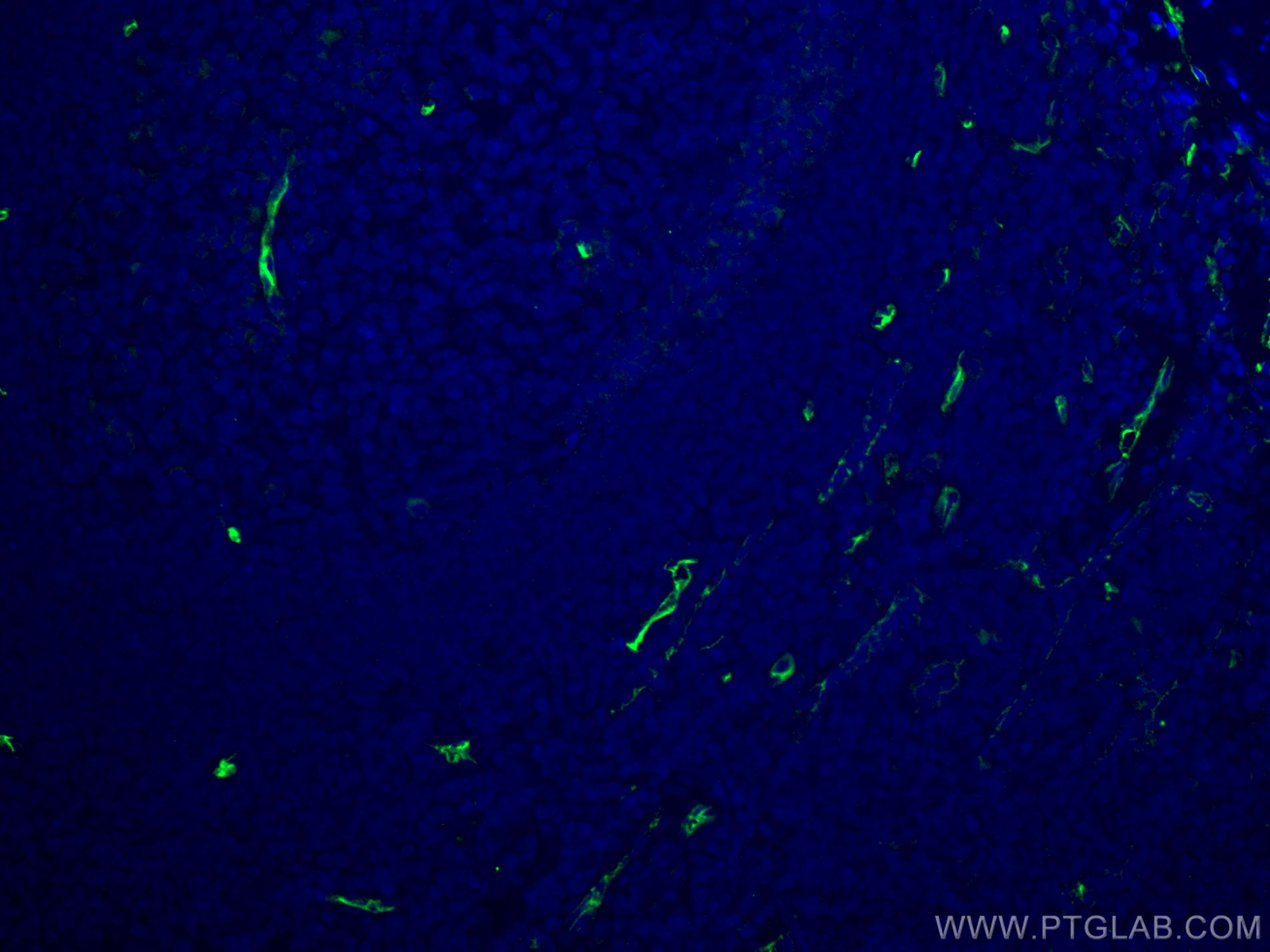 Immunofluorescence (IF) / fluorescent staining of human tonsillitis tissue using CD34 Polyclonal antibody (14486-1-AP)