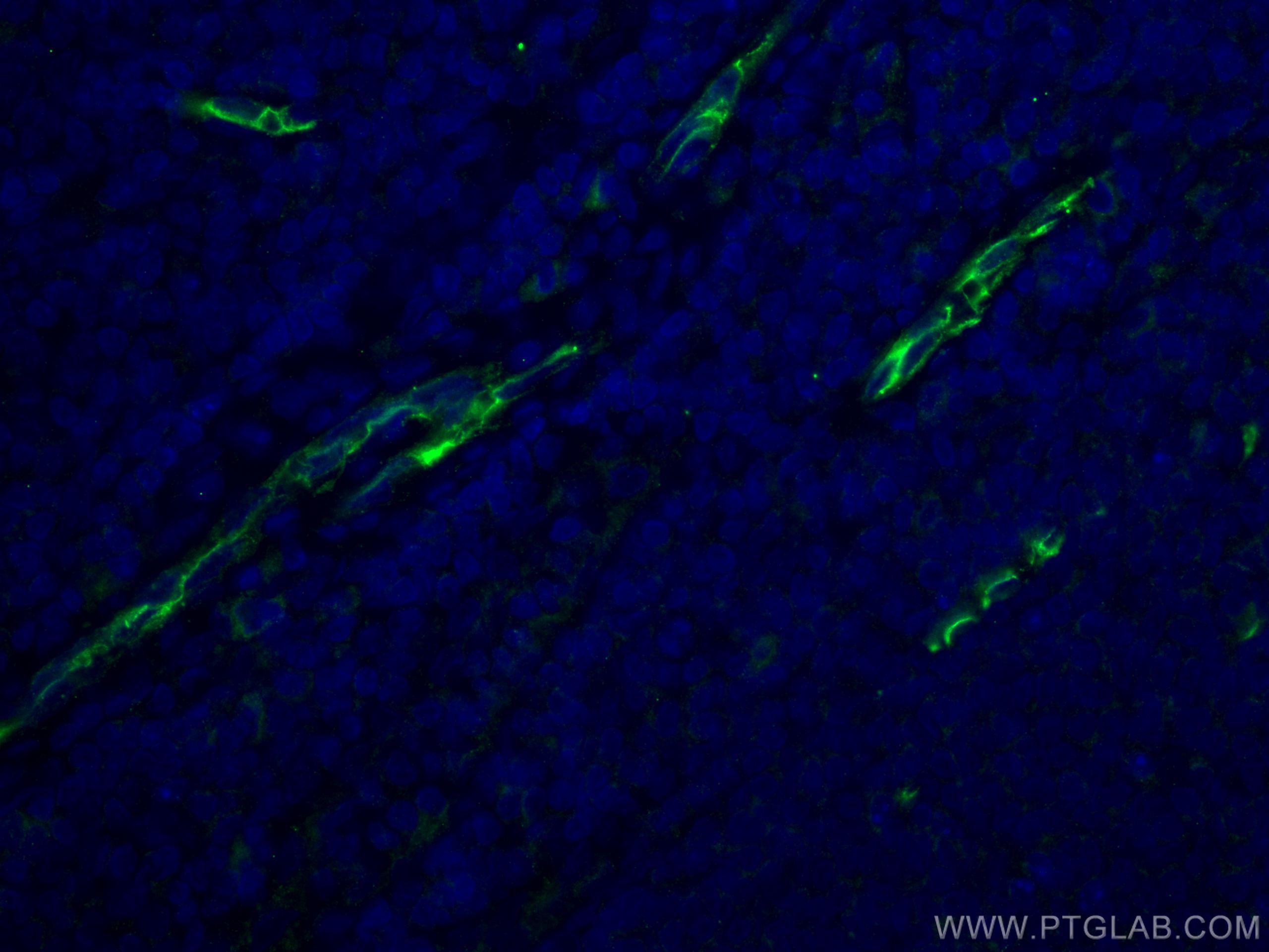 Immunofluorescence (IF) / fluorescent staining of human tonsillitis tissue using CD34 Polyclonal antibody (14486-1-AP)