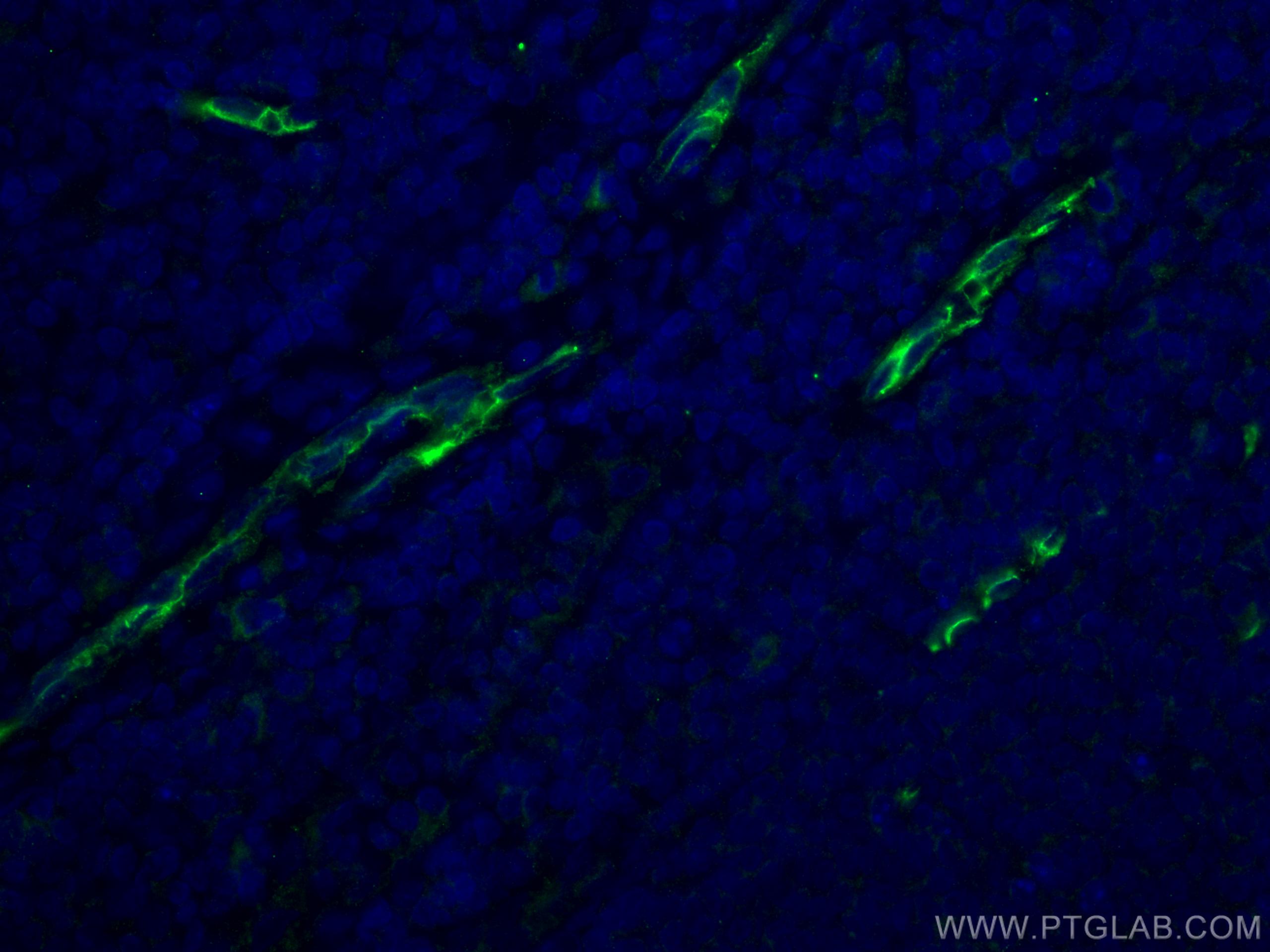 IF Staining of human tonsillitis using 14486-1-AP