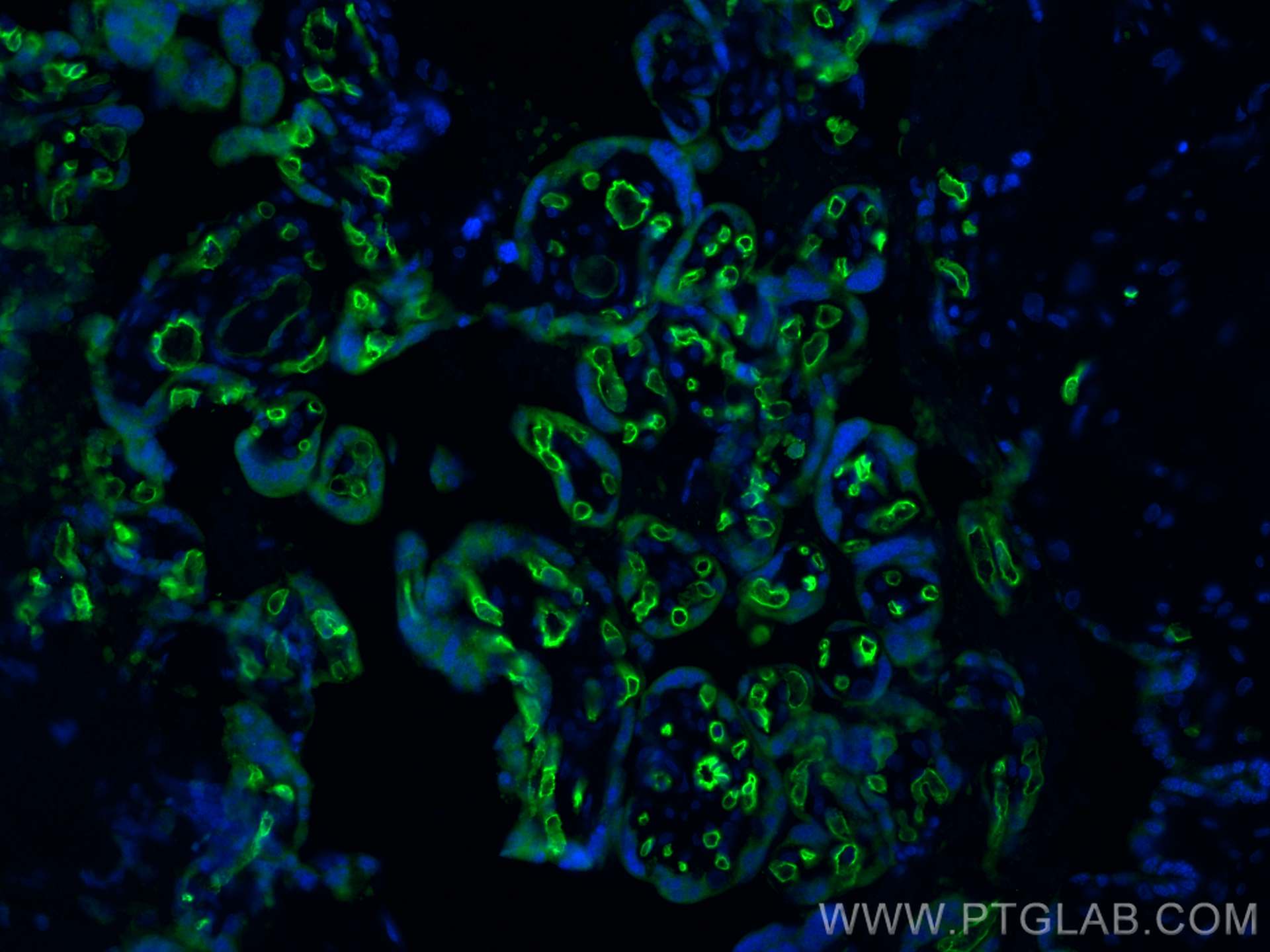 Immunofluorescence (IF) / fluorescent staining of human placenta tissue using CD34 Polyclonal antibody (14486-1-AP)