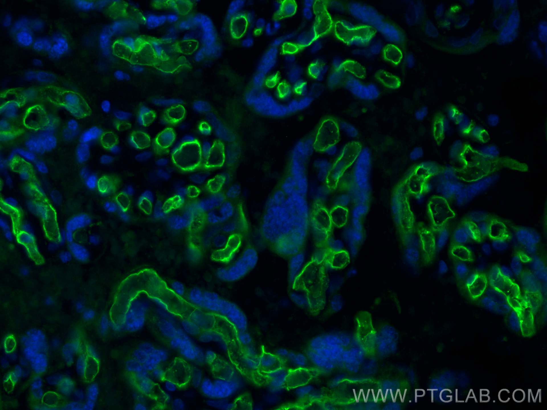 Immunofluorescence (IF) / fluorescent staining of human placenta tissue using CD34 Polyclonal antibody (14486-1-AP)