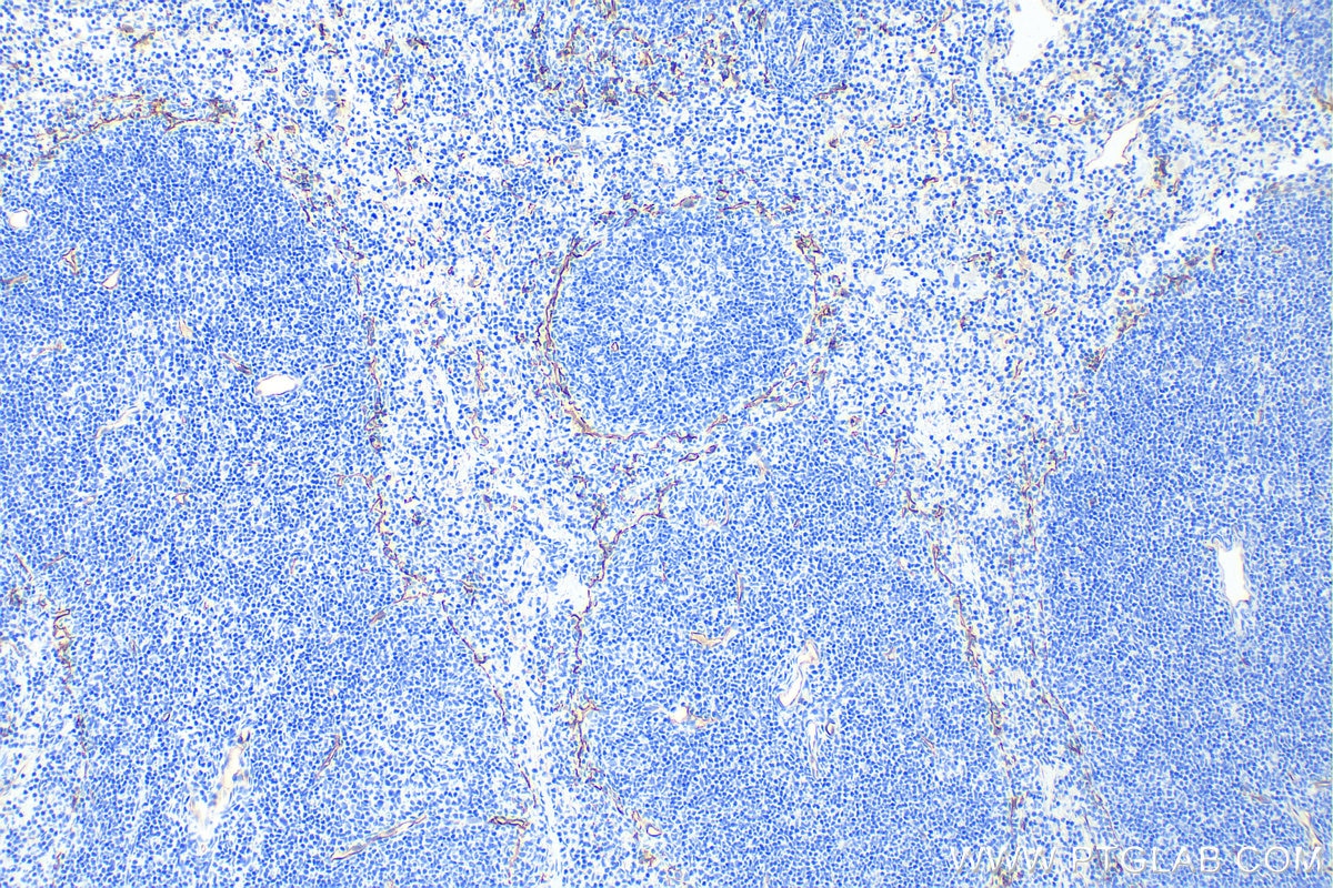 Immunohistochemistry (IHC) staining of mouse spleen tissue using CD34 Polyclonal antibody (31120-1-AP)
