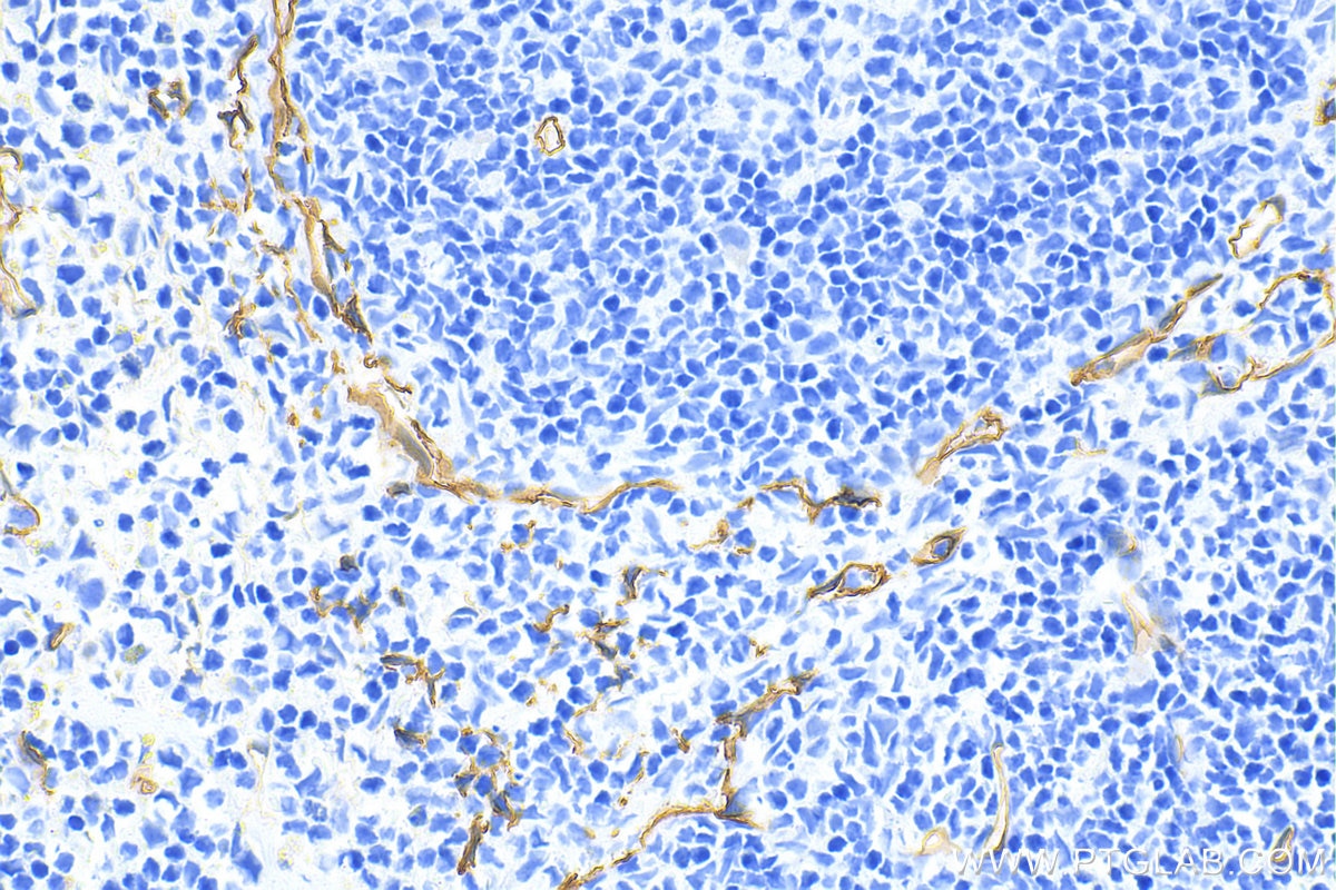 Immunohistochemistry (IHC) staining of mouse spleen tissue using CD34 Polyclonal antibody (31120-1-AP)