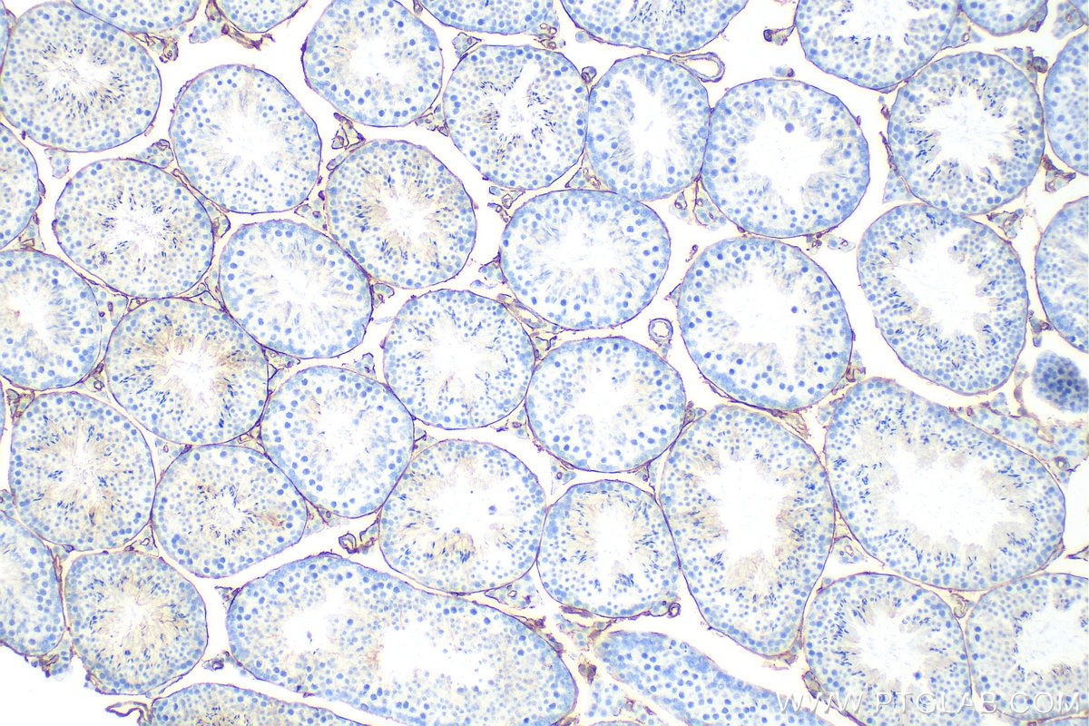 Immunohistochemistry (IHC) staining of mouse testis tissue using CD34 Polyclonal antibody (31120-1-AP)