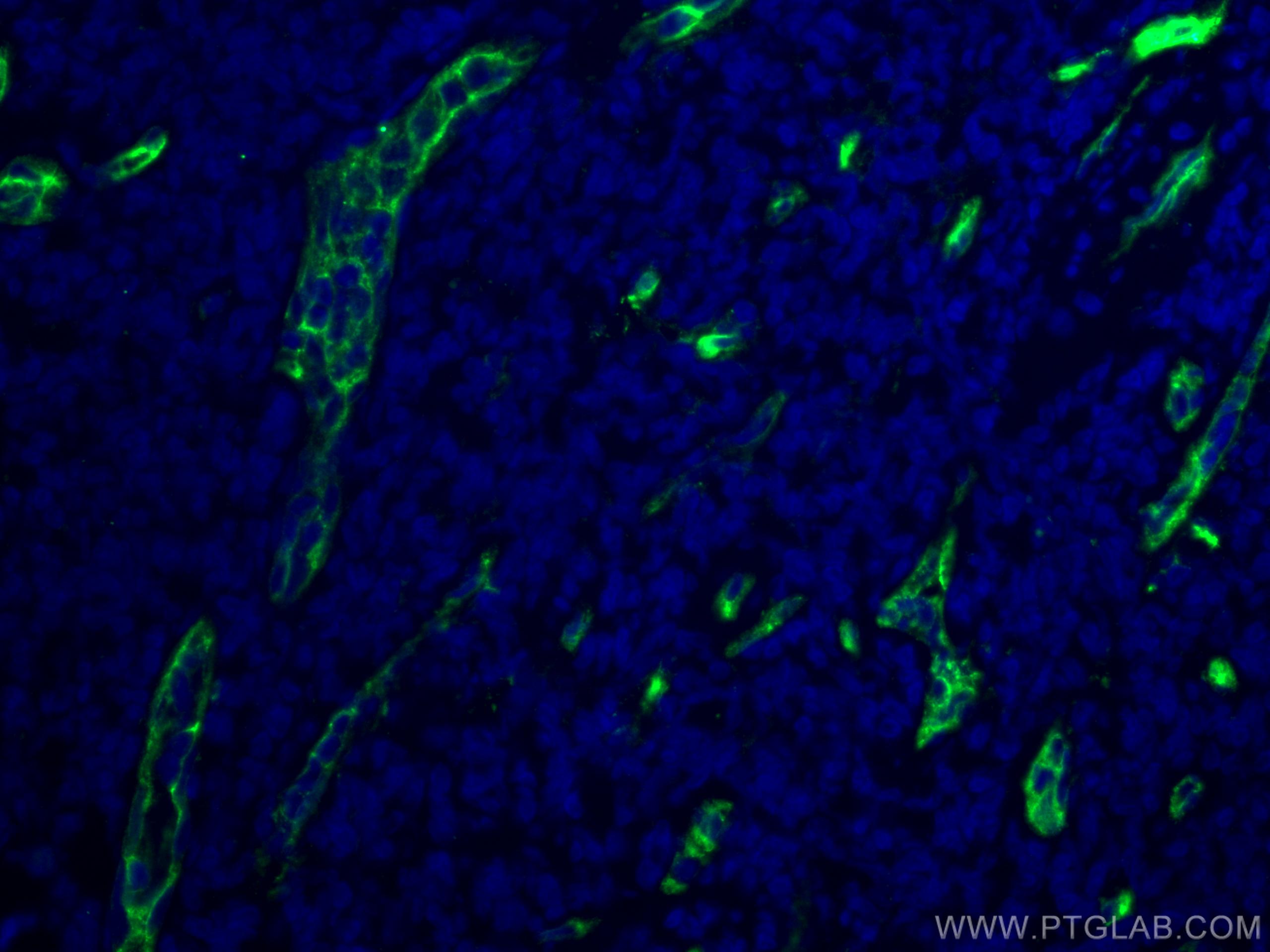 Immunofluorescence (IF) / fluorescent staining of human tonsillitis tissue using CD34 Monoclonal antibody (60180-1-Ig)