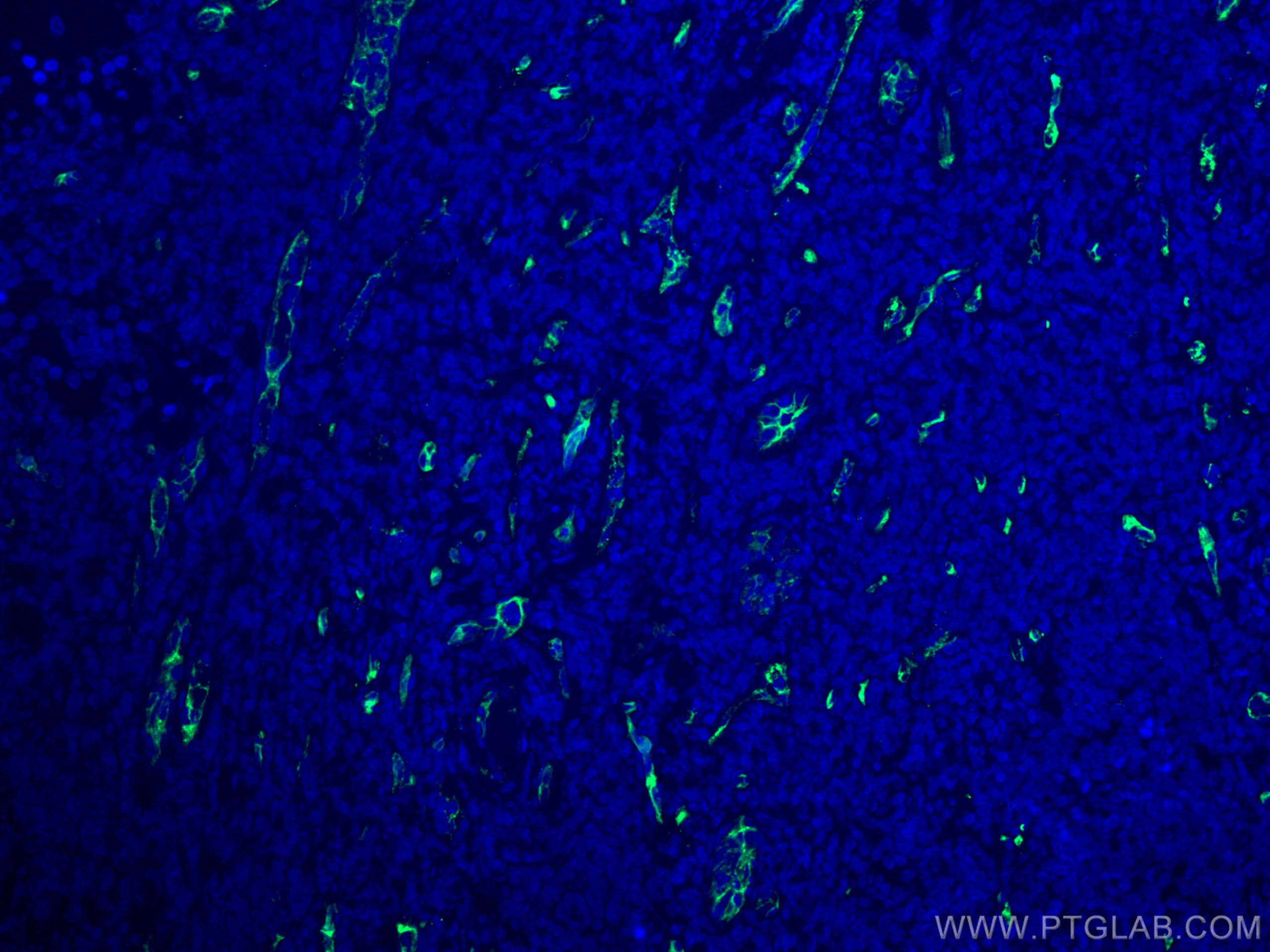 Immunofluorescence (IF) / fluorescent staining of human tonsillitis tissue using CD34 Monoclonal antibody (60180-1-Ig)