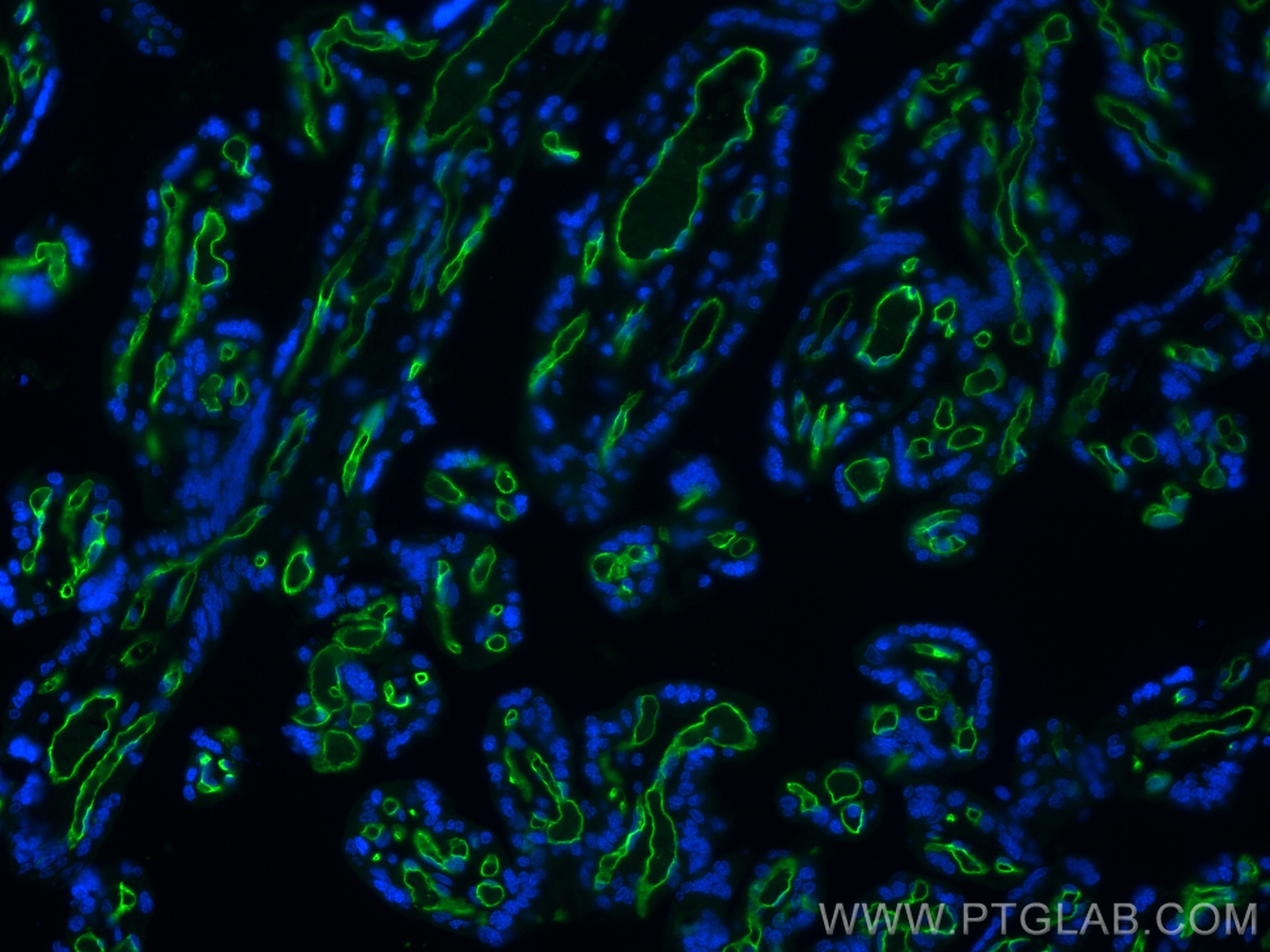 Immunofluorescence (IF) / fluorescent staining of human placenta tissue using CD34 Monoclonal antibody (60180-1-Ig)