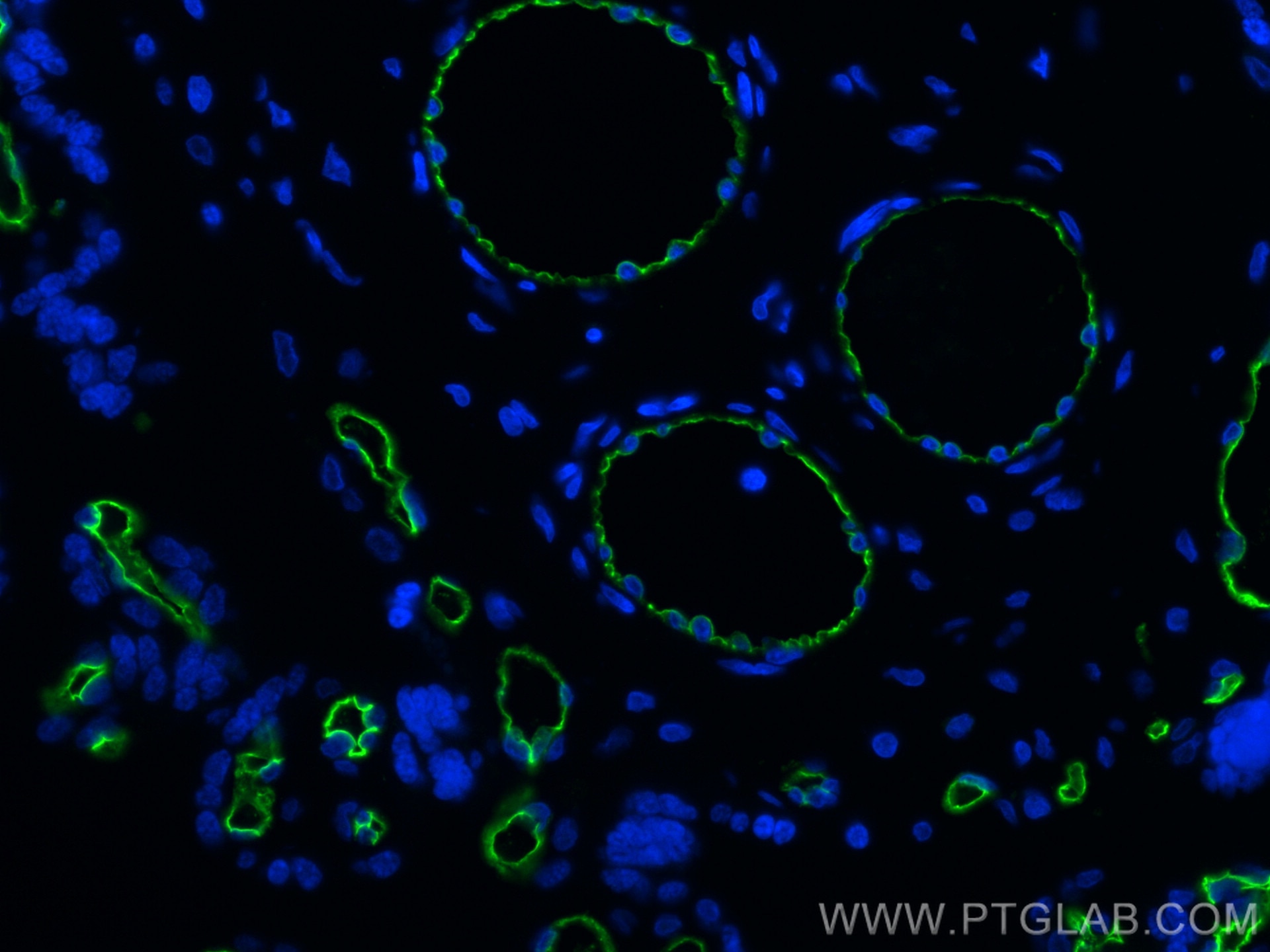 Immunofluorescence (IF) / fluorescent staining of human placenta tissue using CD34 Monoclonal antibody (60180-1-Ig)