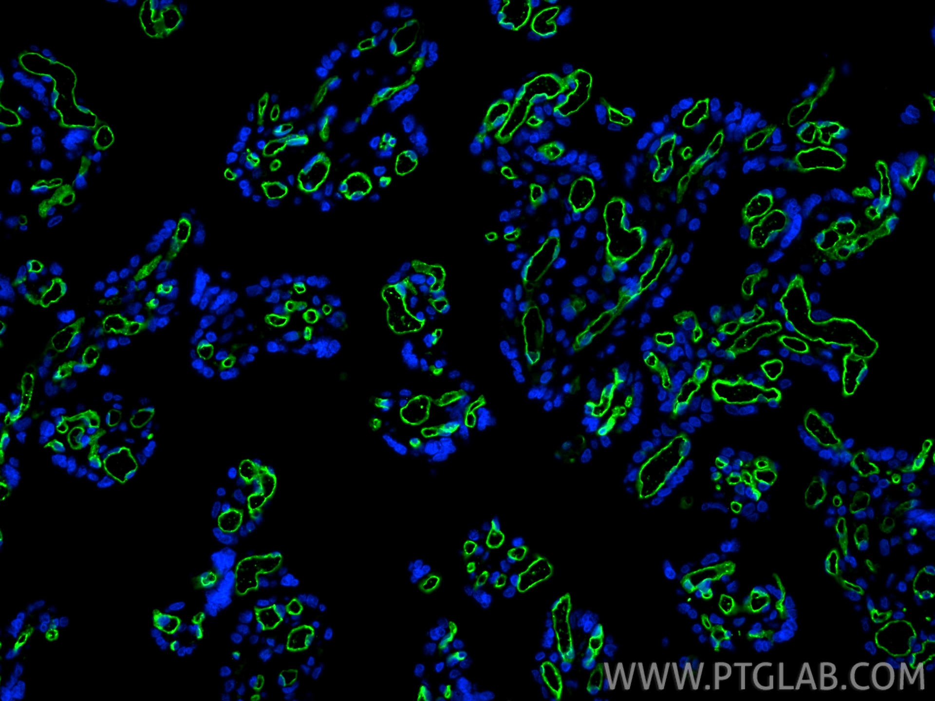Immunofluorescence (IF) / fluorescent staining of human placenta tissue using CD34 Monoclonal antibody (60180-1-Ig)
